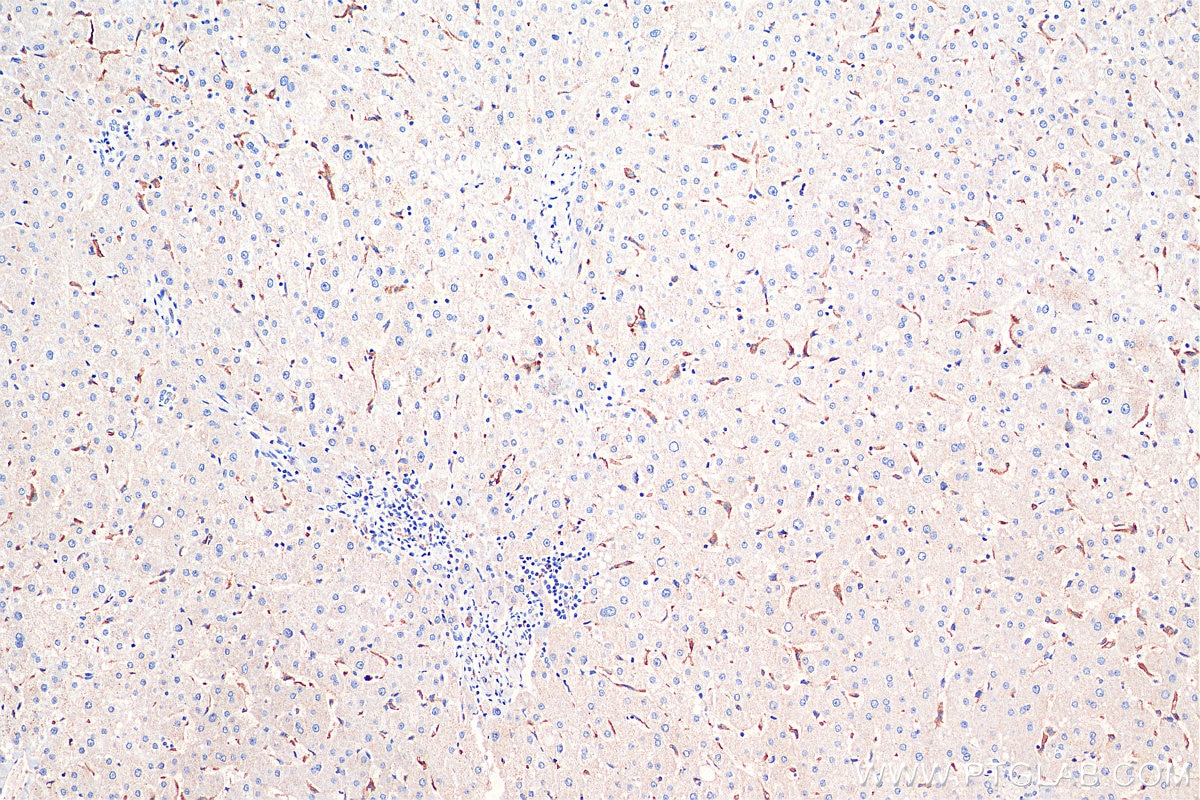 Immunohistochemistry (IHC) staining of human liver tissue using FcRn Monoclonal antibody (67944-1-Ig)