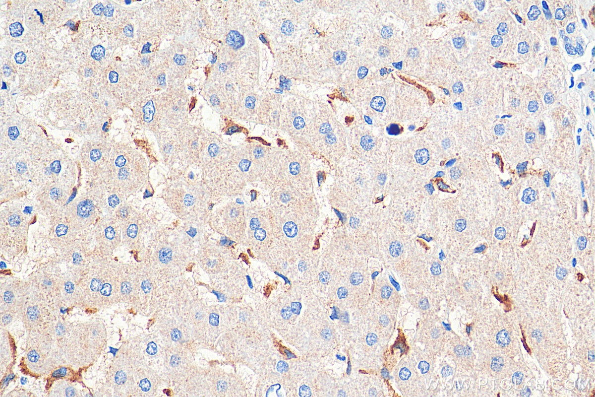 Immunohistochemistry (IHC) staining of human liver tissue using FcRn Monoclonal antibody (67944-1-Ig)