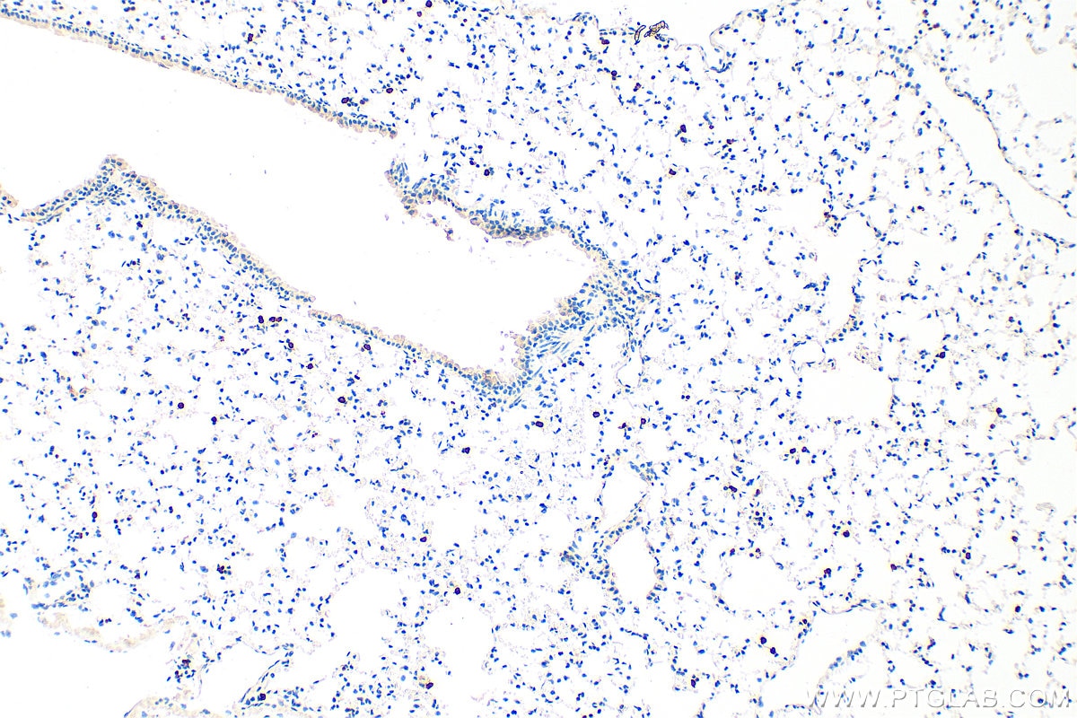 Immunohistochemistry (IHC) staining of mouse lung tissue using FceR1a Polyclonal antibody (32501-1-AP)