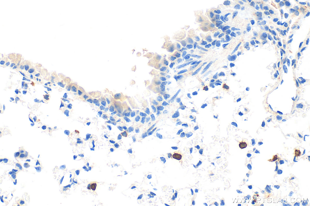Immunohistochemistry (IHC) staining of mouse lung tissue using FceR1a Polyclonal antibody (32501-1-AP)