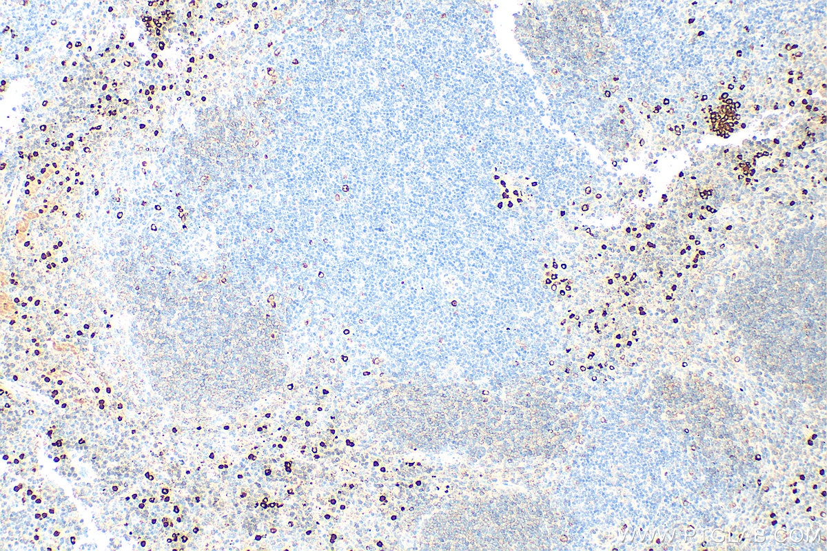 Immunohistochemistry (IHC) staining of mouse spleen tissue using FceR1a Polyclonal antibody (32501-1-AP)