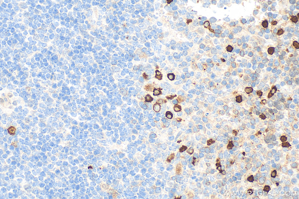 Immunohistochemistry (IHC) staining of mouse spleen tissue using FceR1a Polyclonal antibody (32501-1-AP)