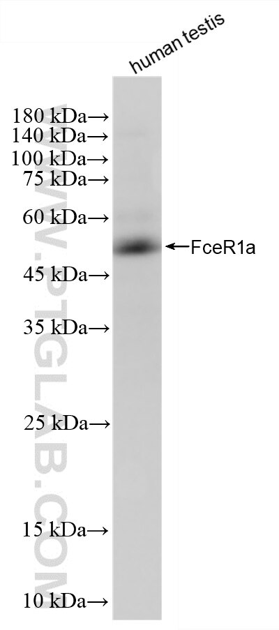 Western Blot (WB) analysis of human testis tissue using FceR1a Recombinant monoclonal antibody (84662-4-RR)
