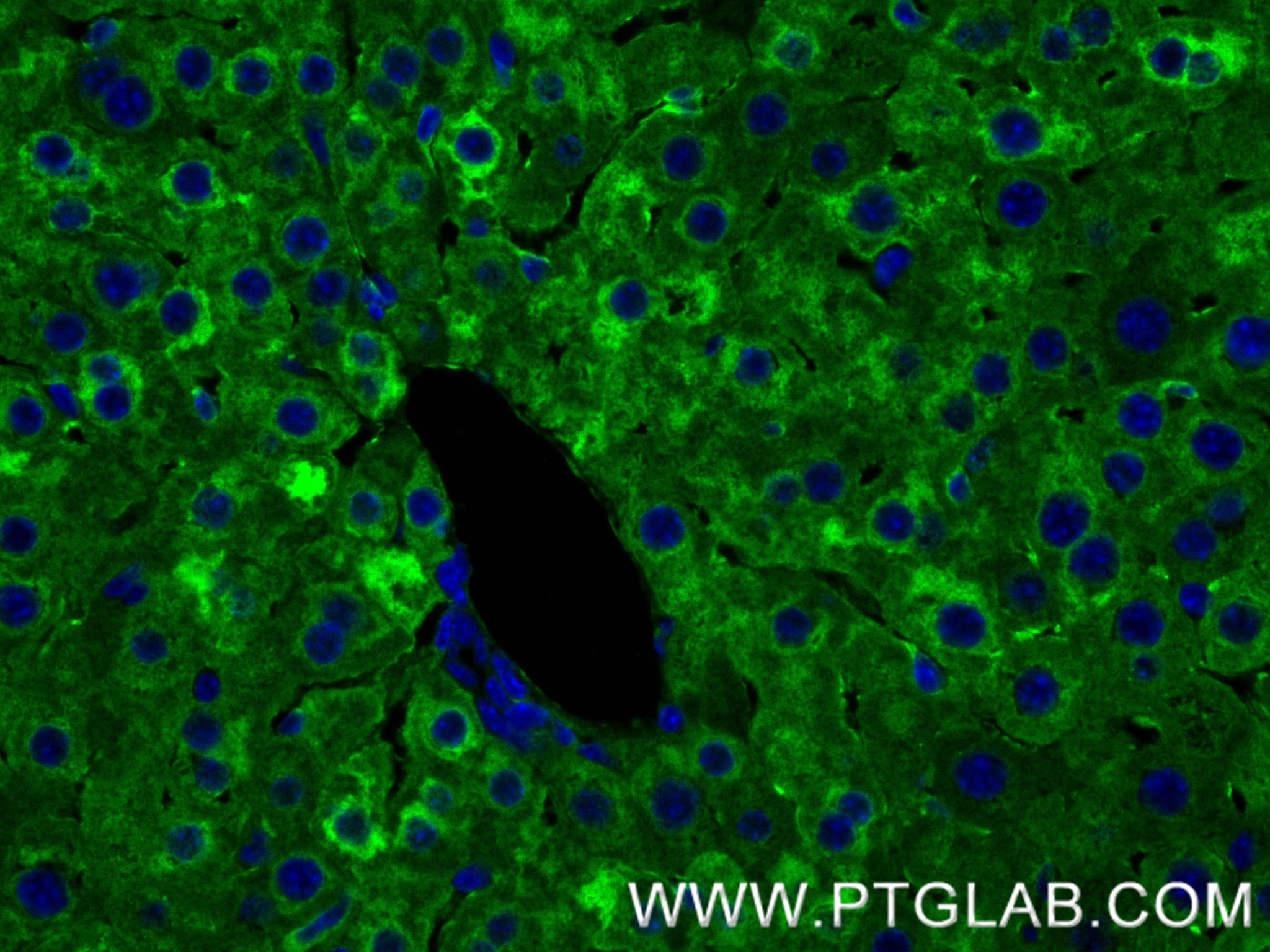 Immunofluorescence (IF) / fluorescent staining of mouse liver tissue using Ferritin light chain 1 Recombinant antibody (84731-7-RR)
