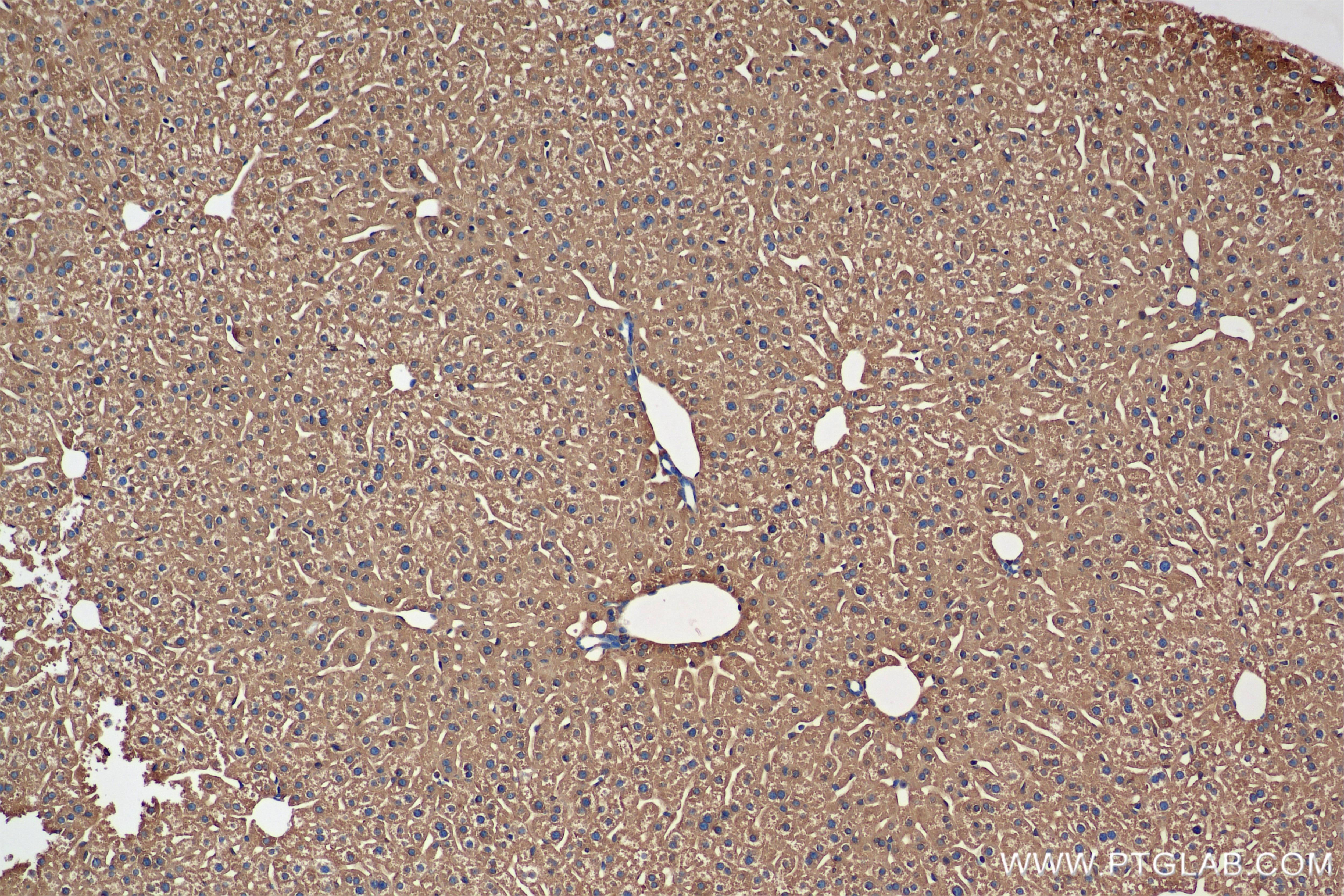 Immunohistochemistry (IHC) staining of mouse liver tissue using Ferritin light chain 1 Recombinant antibody (84731-7-RR)
