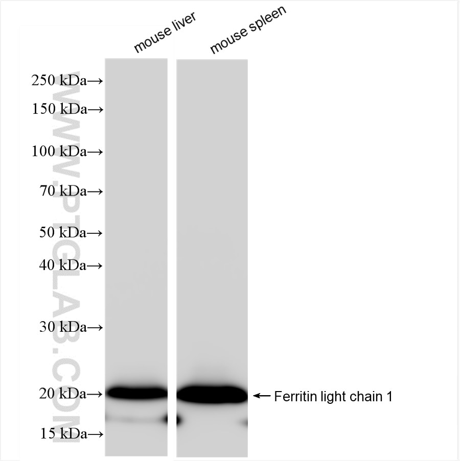 Western Blot (WB) analysis of various lysates using Ferritin light chain 1 Recombinant antibody (84731-7-RR)