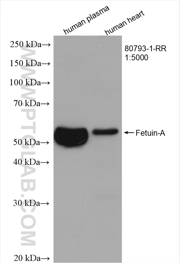 Western Blot (WB) analysis of human plasma using Fetuin-A Recombinant antibody (80793-1-RR)