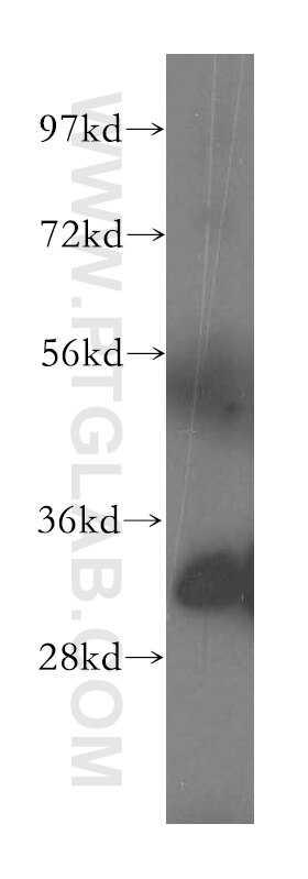 Western Blot (WB) analysis of human heart tissue using Fhl1 Polyclonal antibody (51015-1-AP)