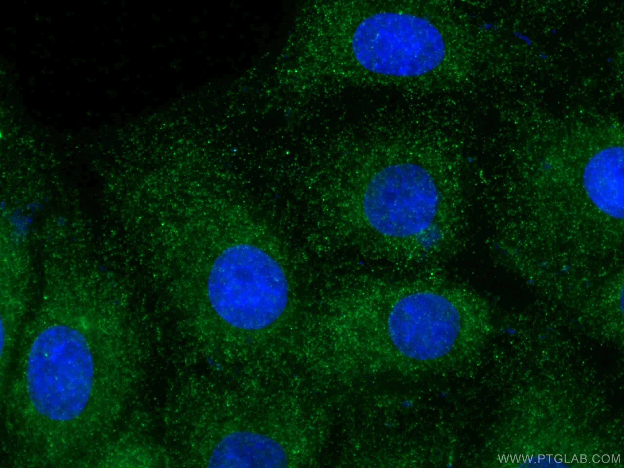 Immunofluorescence (IF) / fluorescent staining of SH-SY5Y cells using Fibrillin 1  Polyclonal antibody (26935-1-AP)