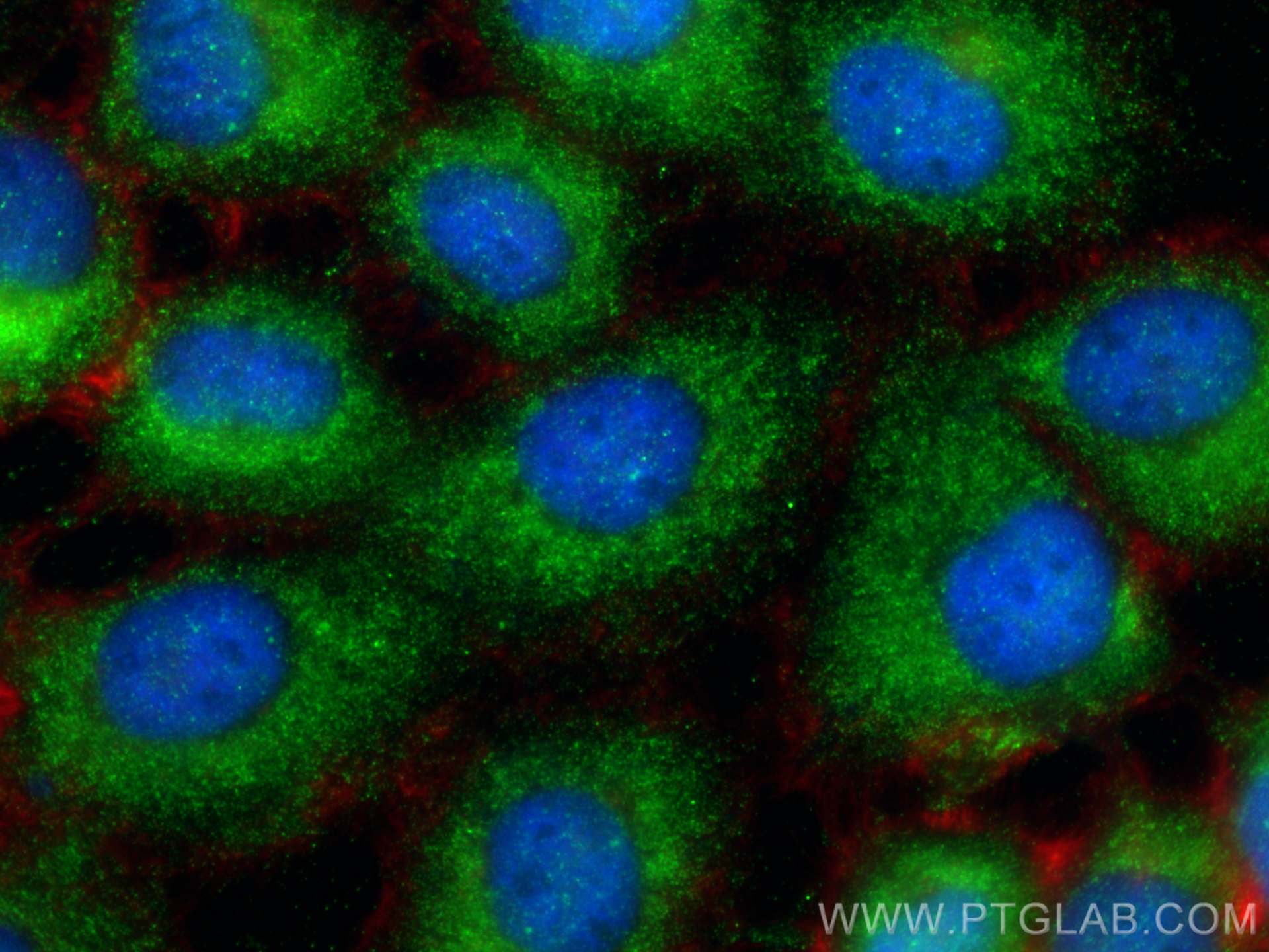 Immunofluorescence (IF) / fluorescent staining of A431 cells using Fibrillin 1 Polyclonal antibody (29425-1-AP)