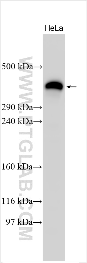 Western Blot (WB) analysis of various lysates using Fibrillin 1 Polyclonal antibody (29425-1-AP)