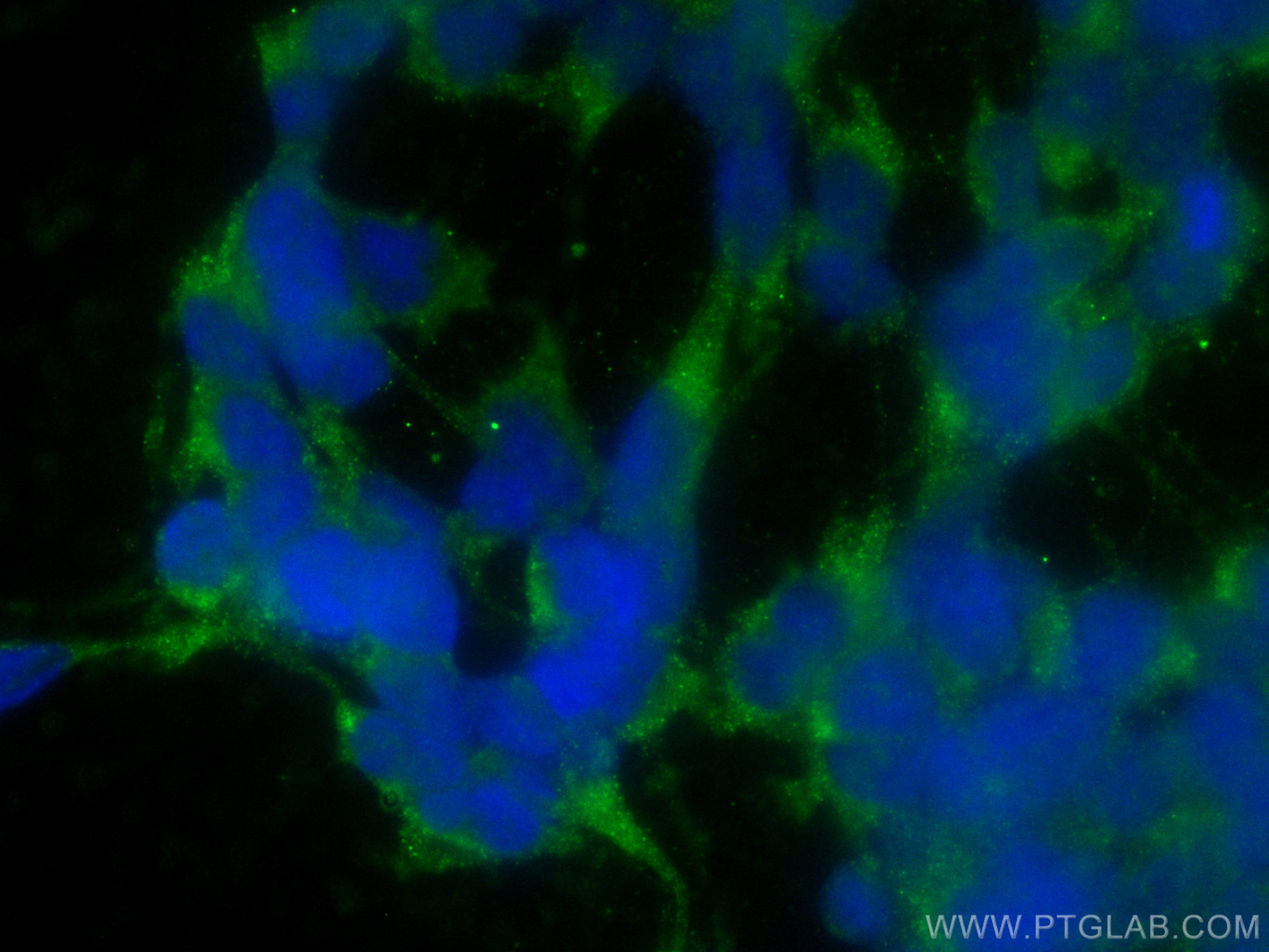 Immunofluorescence (IF) / fluorescent staining of SH-SY5Y cells using CoraLite® Plus 488-conjugated Fibrillin 1  Polyclo (CL488-26935)