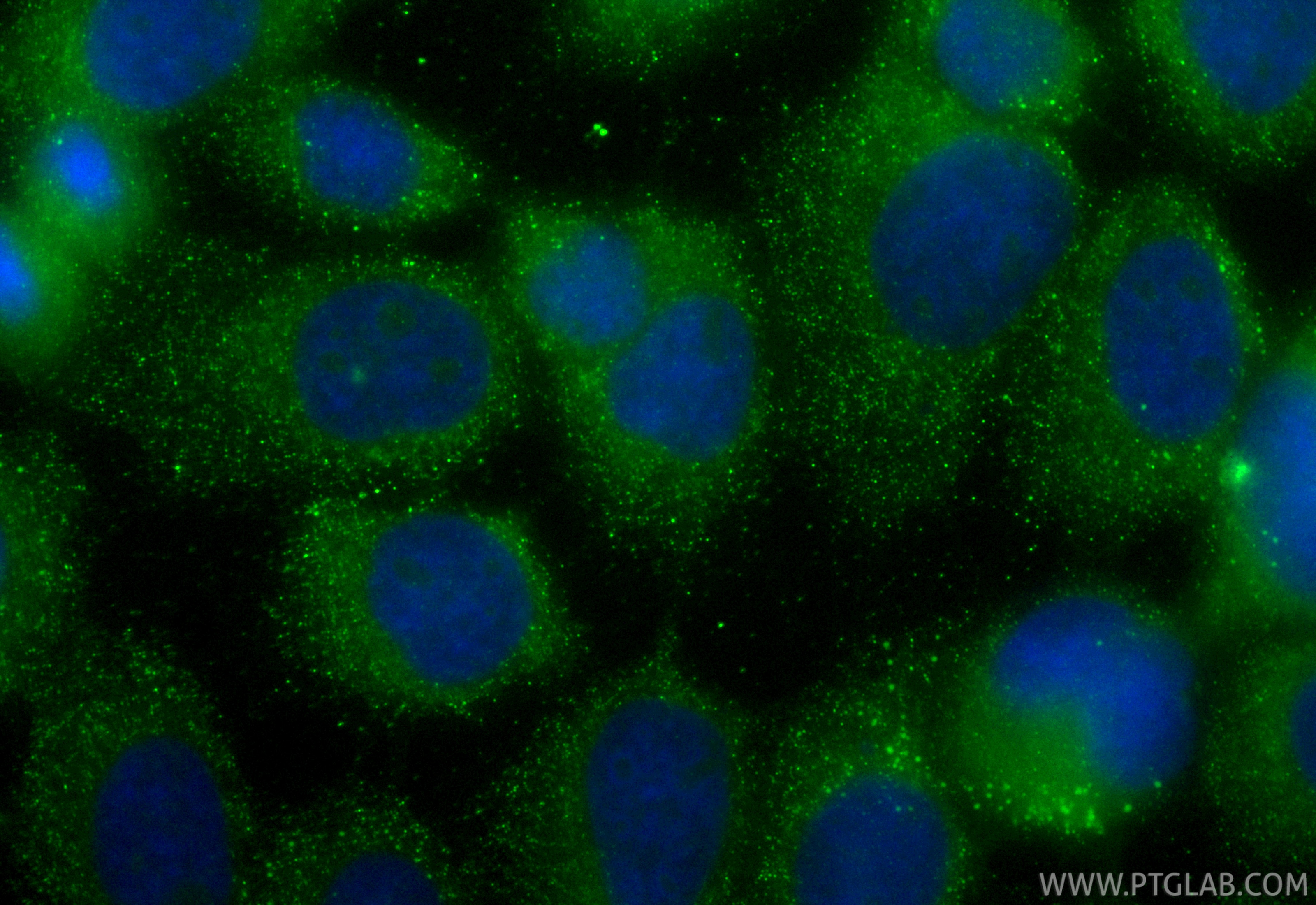 Immunofluorescence (IF) / fluorescent staining of A431 cells using CoraLite® Plus 488-conjugated Fibrillin 1  Polyclo (CL488-26935)
