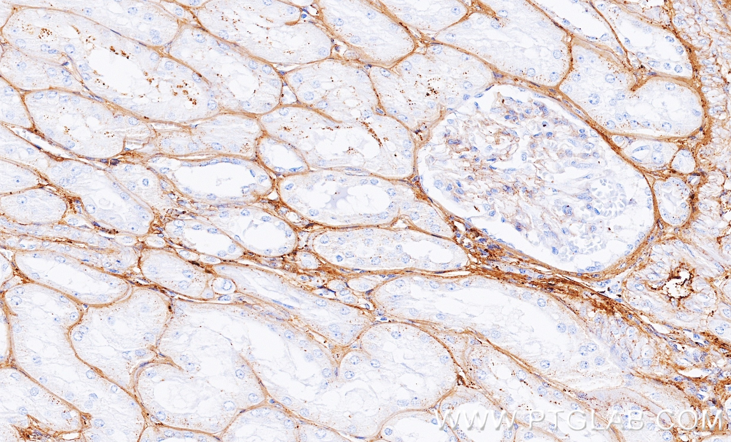 IHC staining of human kidney using 86913-6-RR (same clone as 86913-6-PBS) Immunohistochemistry (IHC) staining of human kidney tissue using Fibrinogen Alpha Chain Recombinant monoclonal anti (86913-6-RR)