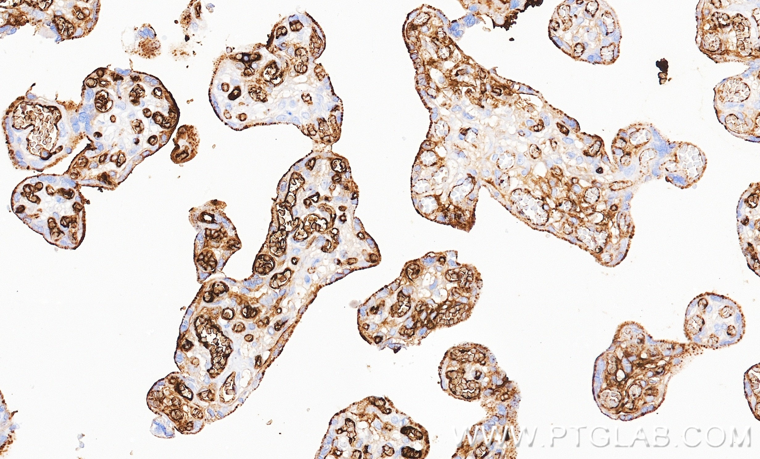 IHC staining of human placenta using 86913-6-RR (same clone as 86913-6-PBS) Immunohistochemistry (IHC) staining of human placenta tissue using Fibrinogen Alpha Chain Recombinant monoclonal anti (86913-6-RR)