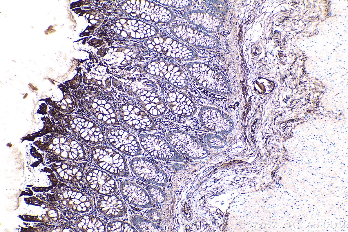 Immunohistochemistry (IHC) staining of human colon tissue using Fibrinogen Alpha Chain Polyclonal antibody (20645-1-AP)