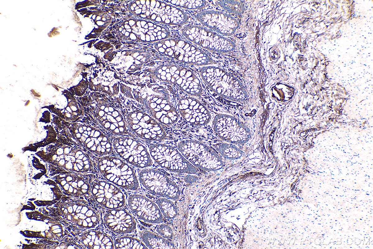 IHC staining of human colon using 20645-1-AP