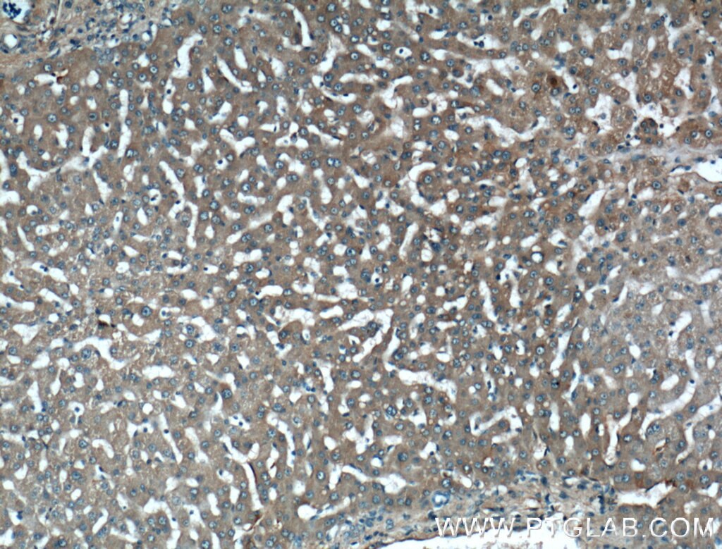 Immunohistochemistry (IHC) staining of human liver tissue using Fibrinogen Alpha Chain Polyclonal antibody (20645-1-AP)