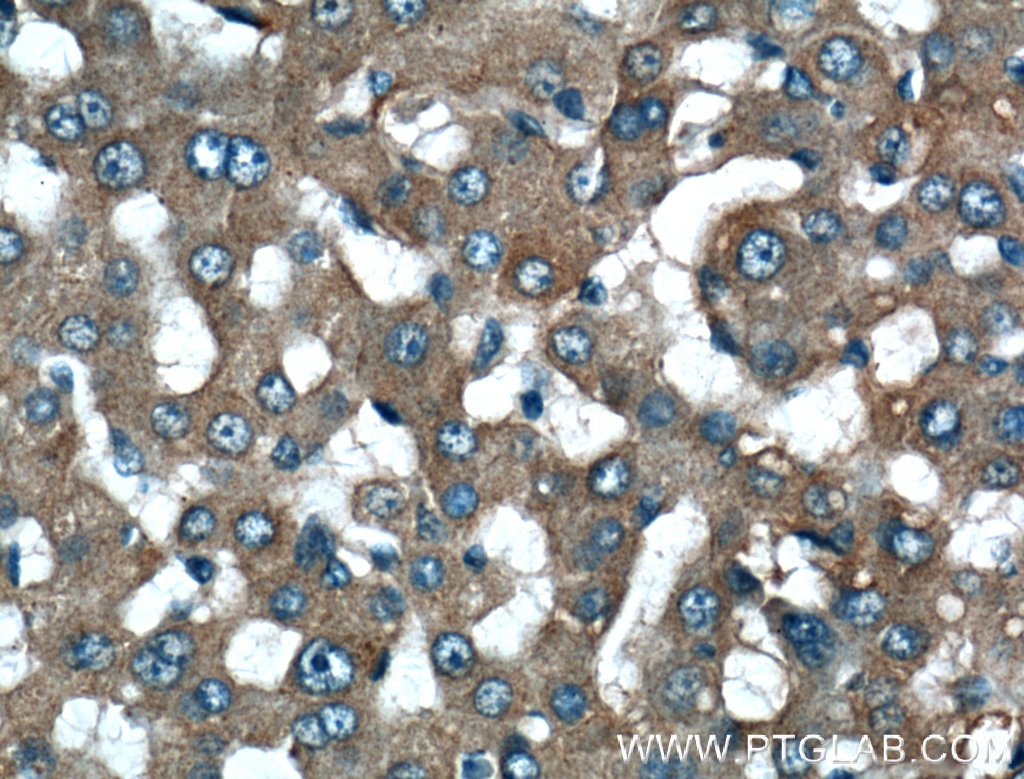 Immunohistochemistry (IHC) staining of human liver tissue using Fibrinogen Alpha Chain Polyclonal antibody (20645-1-AP)
