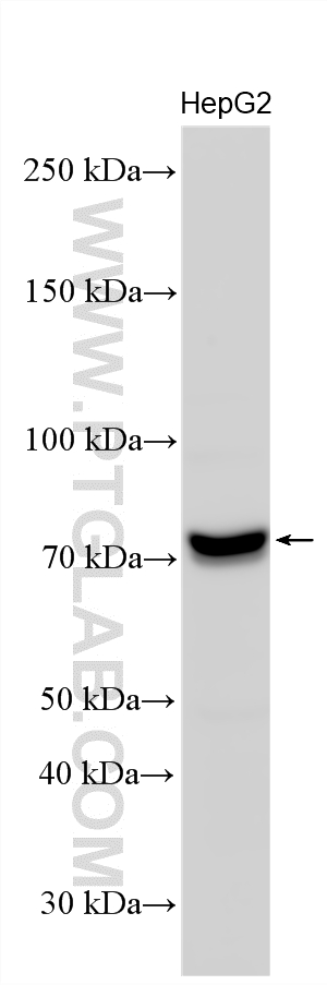 Western Blot (WB) analysis of various lysates using Fibrinogen Alpha Chain Polyclonal antibody (20645-1-AP)