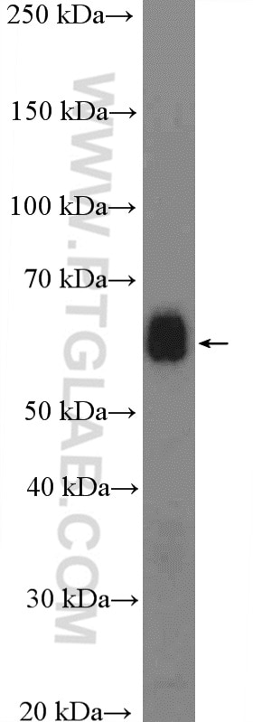 Western Blot (WB) analysis of mouse liver tissue using Fibrinogen Alpha Chain Polyclonal antibody (20645-1-AP)