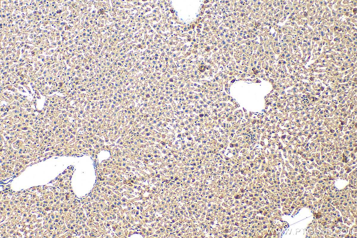 Immunohistochemistry (IHC) staining of mouse liver tissue using Fibroblast activation protein alpha Polyclonal ant (27596-1-AP)