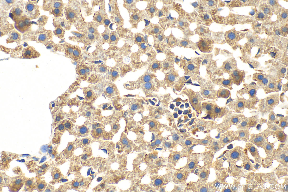 Immunohistochemistry (IHC) staining of mouse liver tissue using Fibroblast activation protein alpha Polyclonal ant (27596-1-AP)