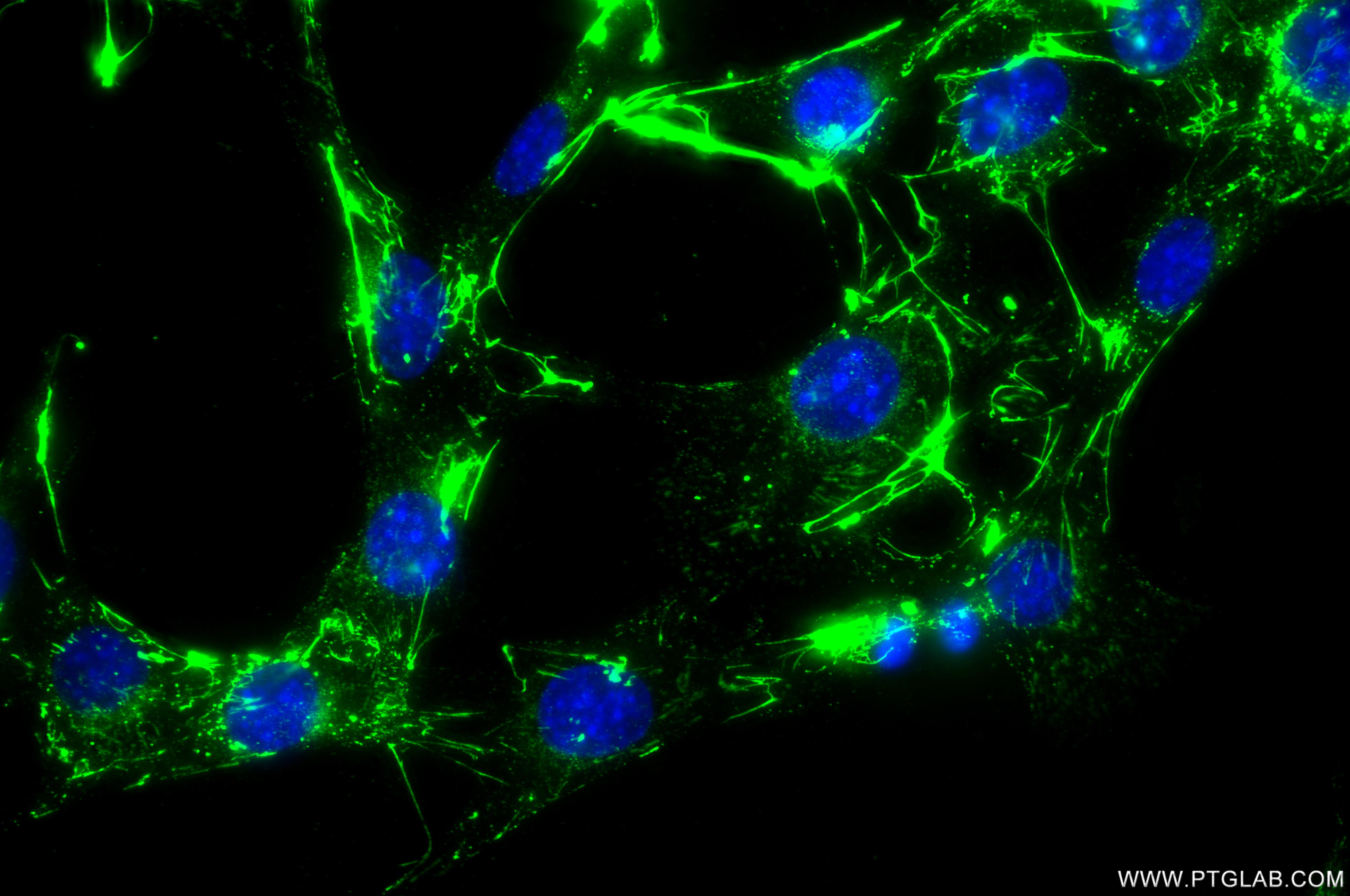 IF Staining of NIH/3T3 using 80911-4-RR Immunofluorescence (IF) / fluorescent staining of NIH/3T3 cells using Fibronectin Recombinant monoclonal antibody (80911-4-RR)
