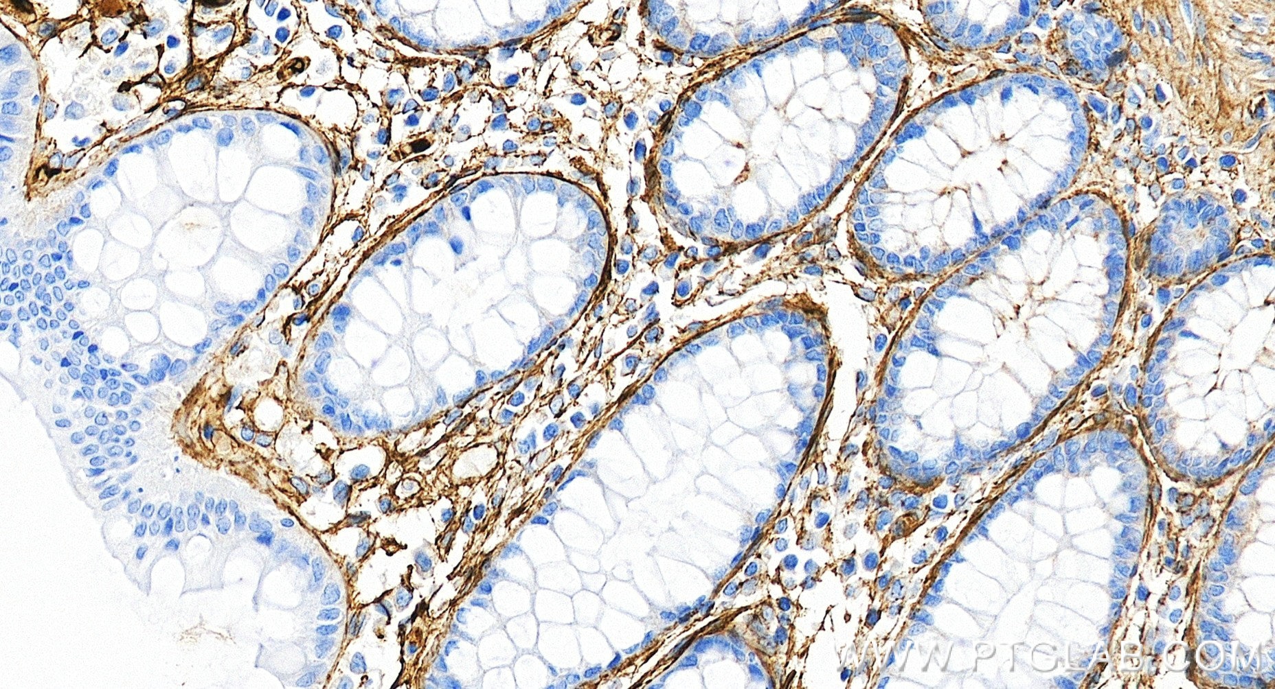 IHC staining of human colon using 98652-2-RR (same clone as 98652-2-PBS) Immunohistochemistry (IHC) staining of human colon tissue using Anti-Human Fibronectin Rabbit Recombinant Antibody (98652-2-RR)