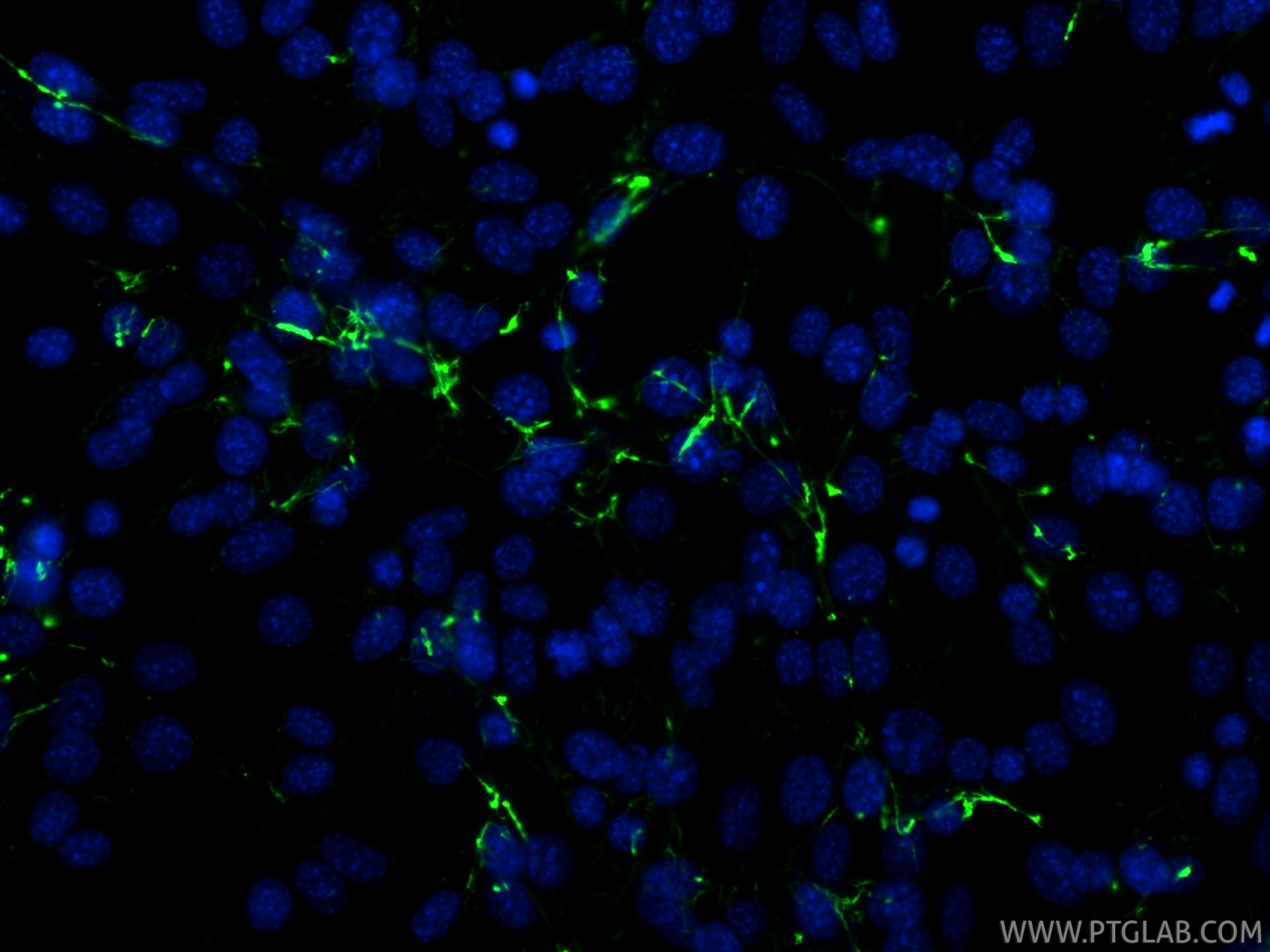 IF Staining of NIH/3T3 using 98652-2-RR (same clone as 98652-2-PBS) Immunofluorescence (IF) / fluorescent staining of NIH/3T3 cells using Anti-Human Fibronectin Rabbit Recombinant Antibody (98652-2-RR)