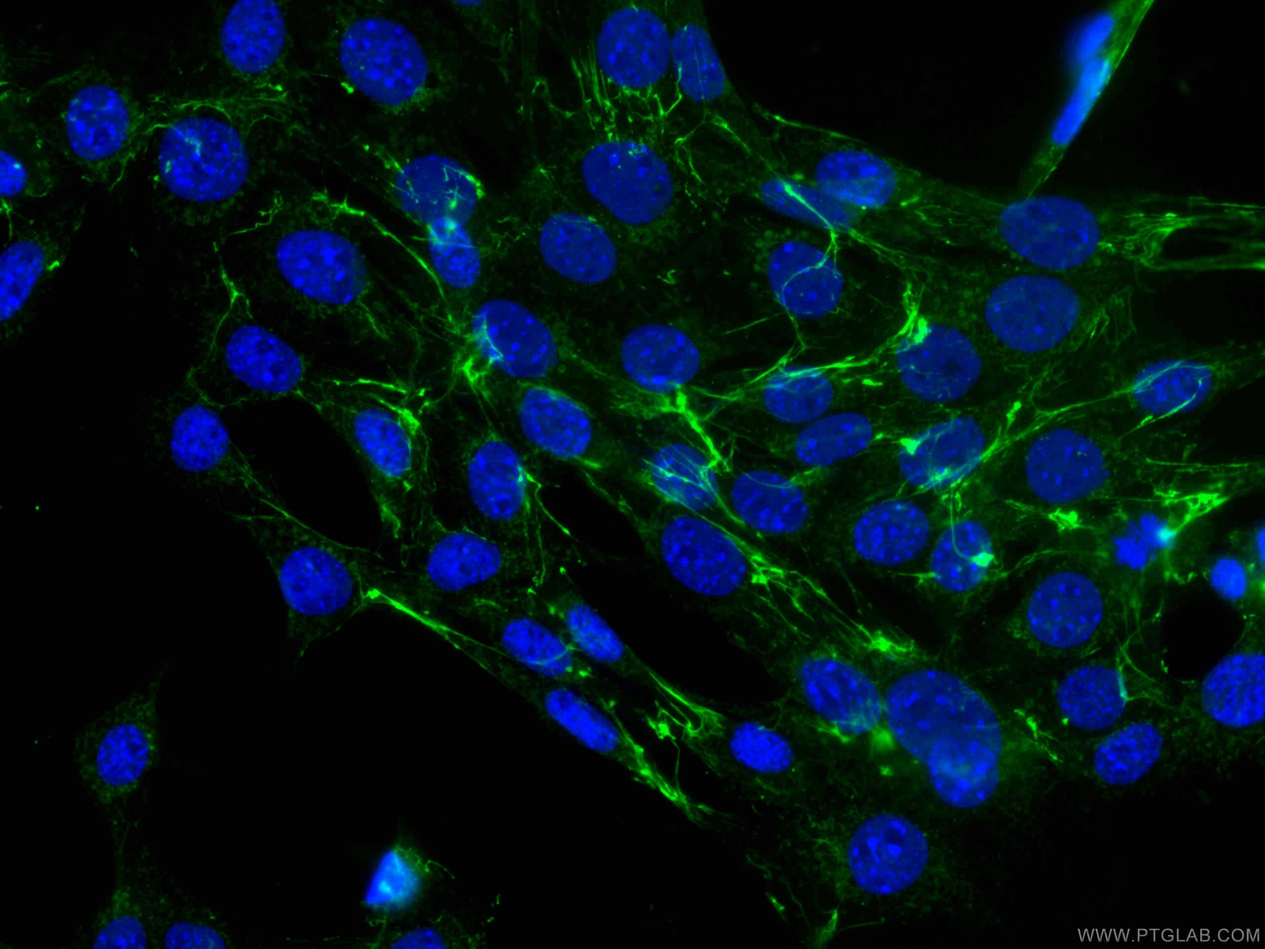 Immunofluorescence (IF) / fluorescent staining of NIH/3T3 cells using CoraLite® Plus 488-conjugated Fibronectin Monoclon (CL488-66042)