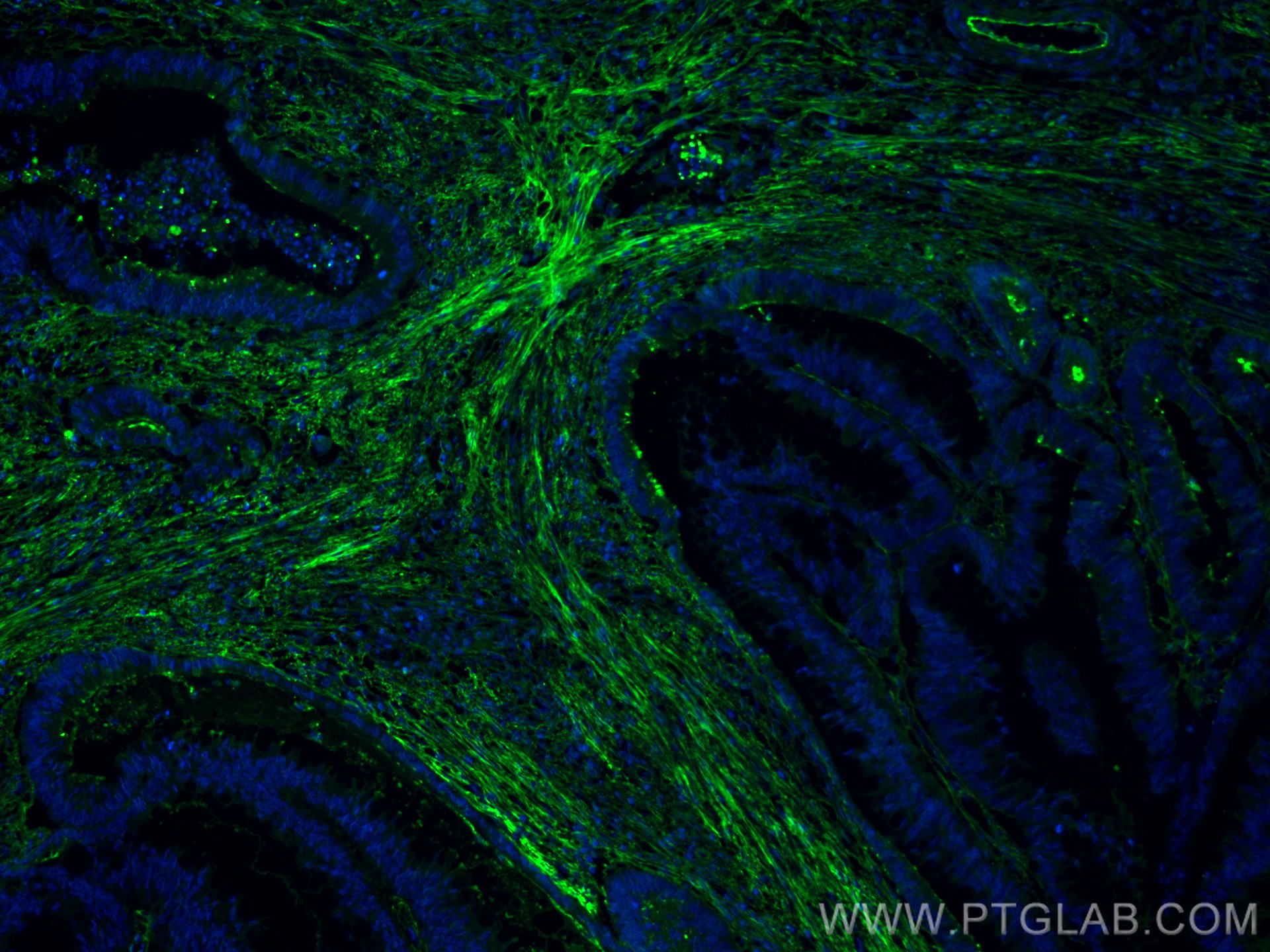 Fibronectin