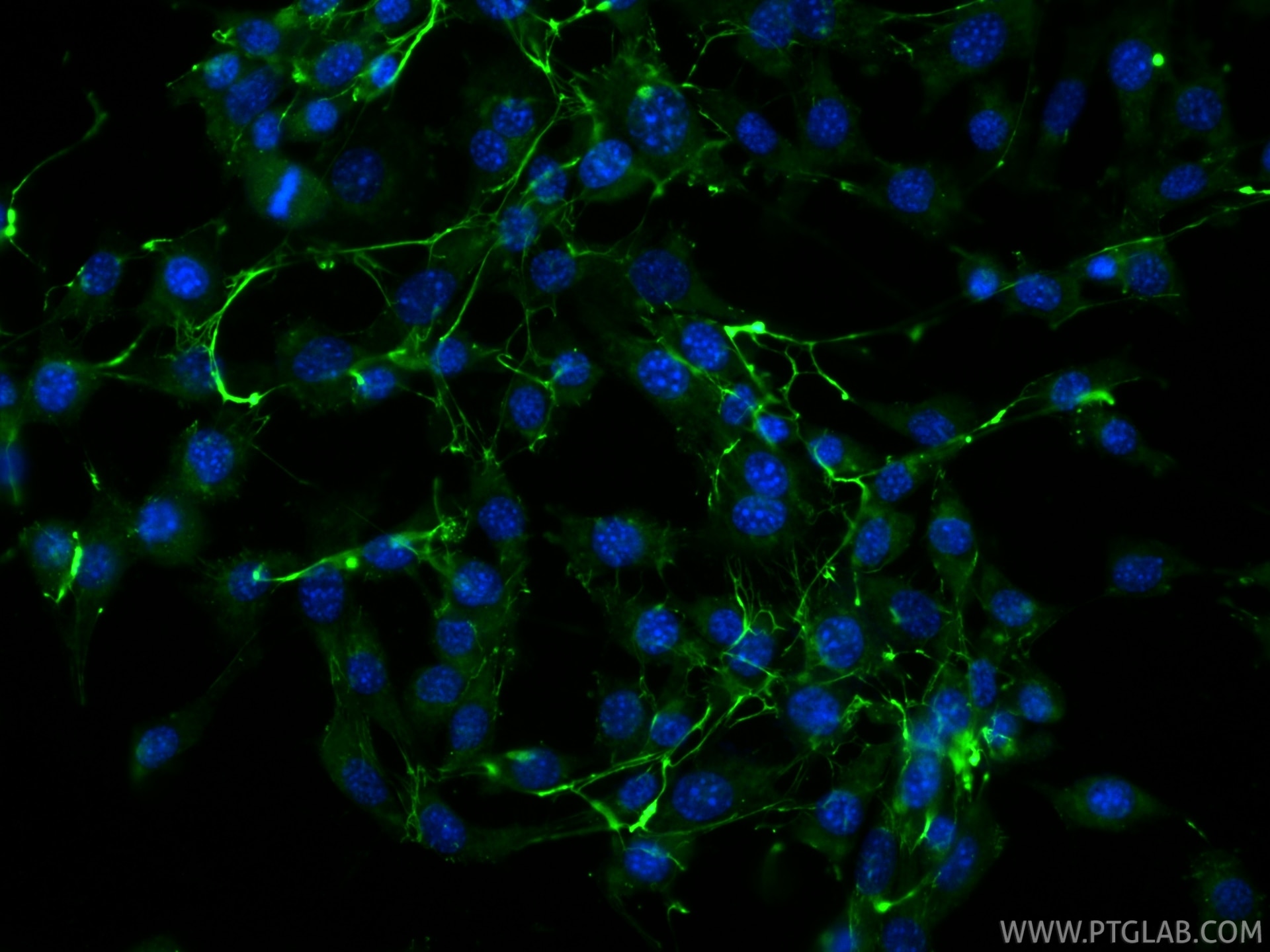IF Staining of NIH/3T3 using CL488-80911-4 Immunofluorescence (IF) / fluorescent staining of NIH/3T3 cells using CoraLite® Plus 488-conjugated Fibronectin Recombin (CL488-80911-4)