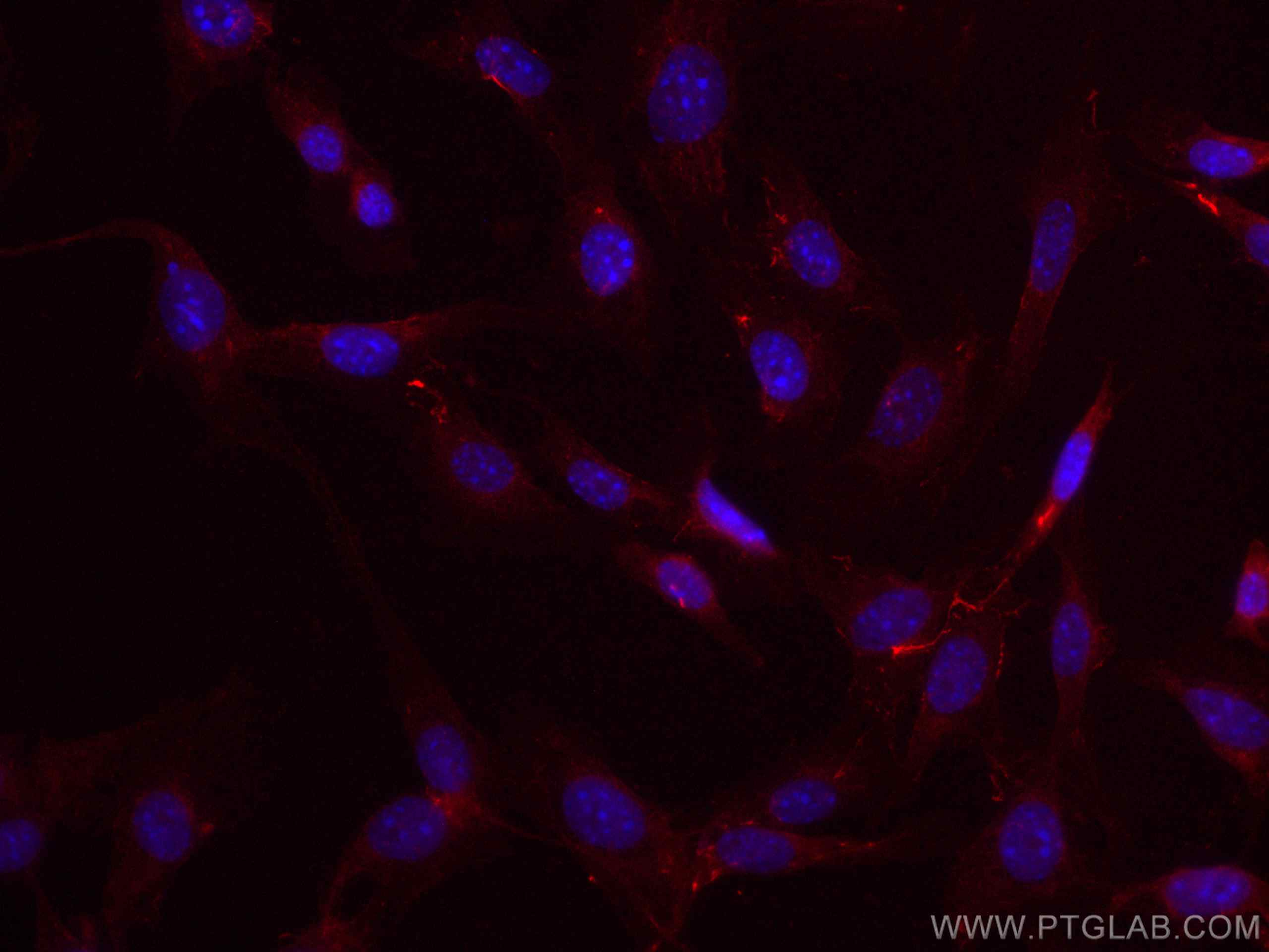 Fibronectin