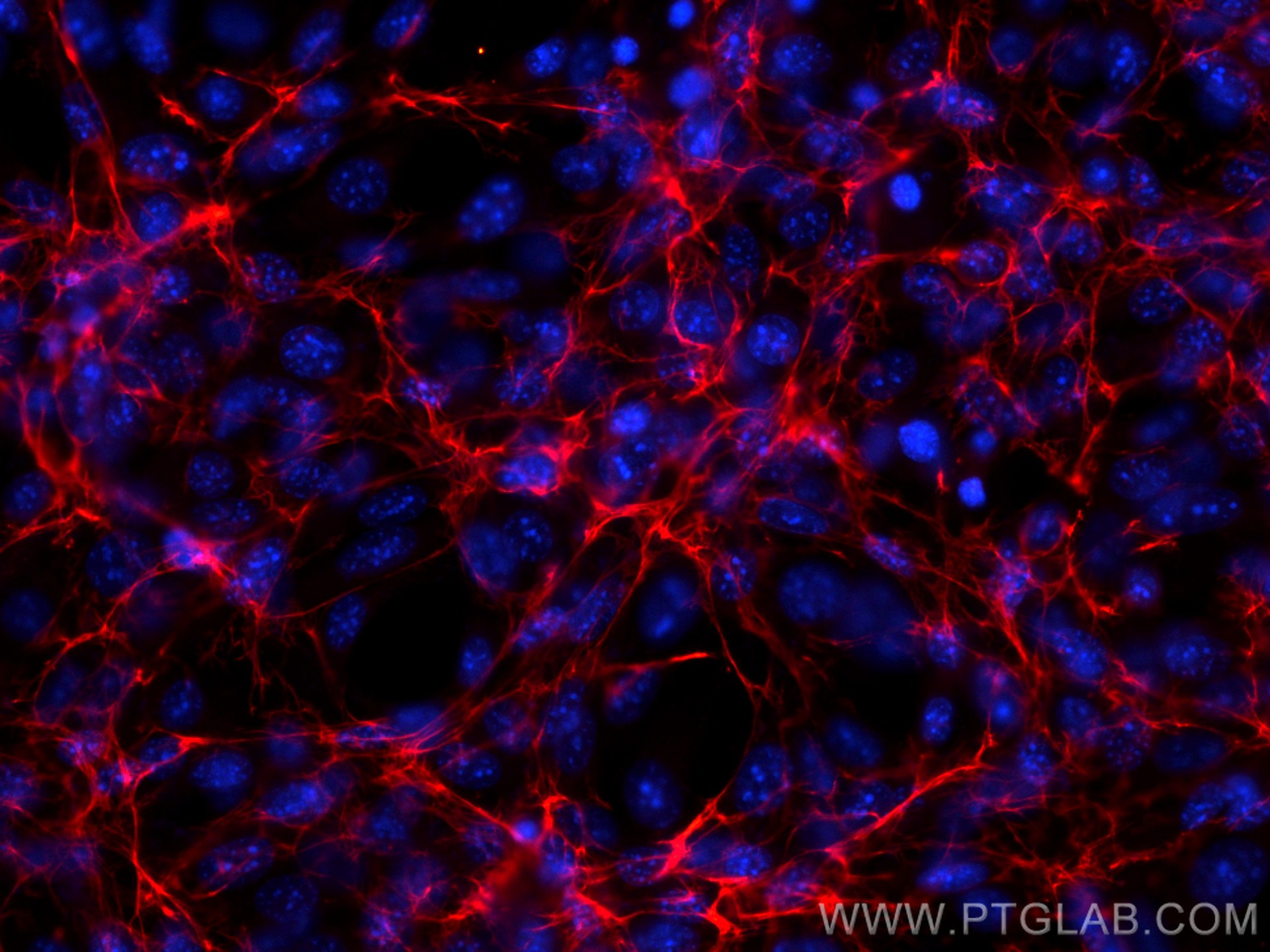 Immunofluorescence (IF) / fluorescent staining of NIH/3T3 cells using CoraLite®594-conjugated Fibronectin Polyclonal ant (CL594-15613)