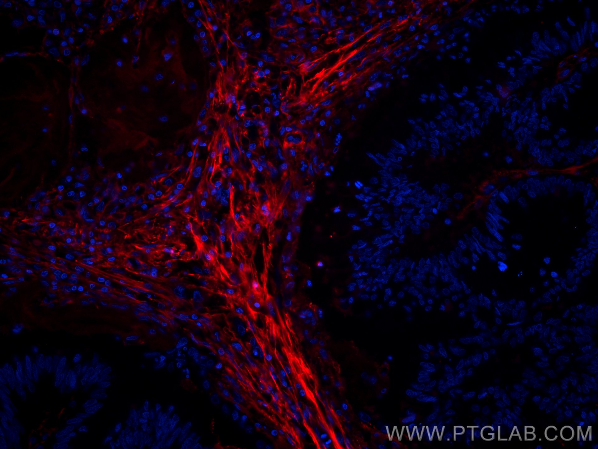 Fibronectin