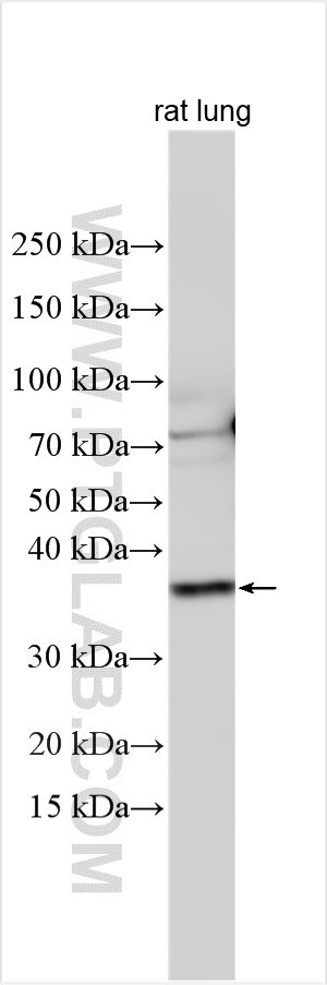Western Blot (WB) analysis of various lysates using Ficolin 2 Polyclonal antibody (32442-1-AP)