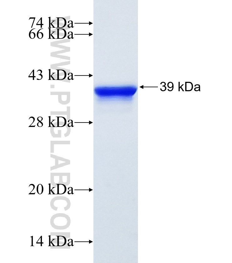 Filaggrin fusion protein Ag25389 SDS-PAGE