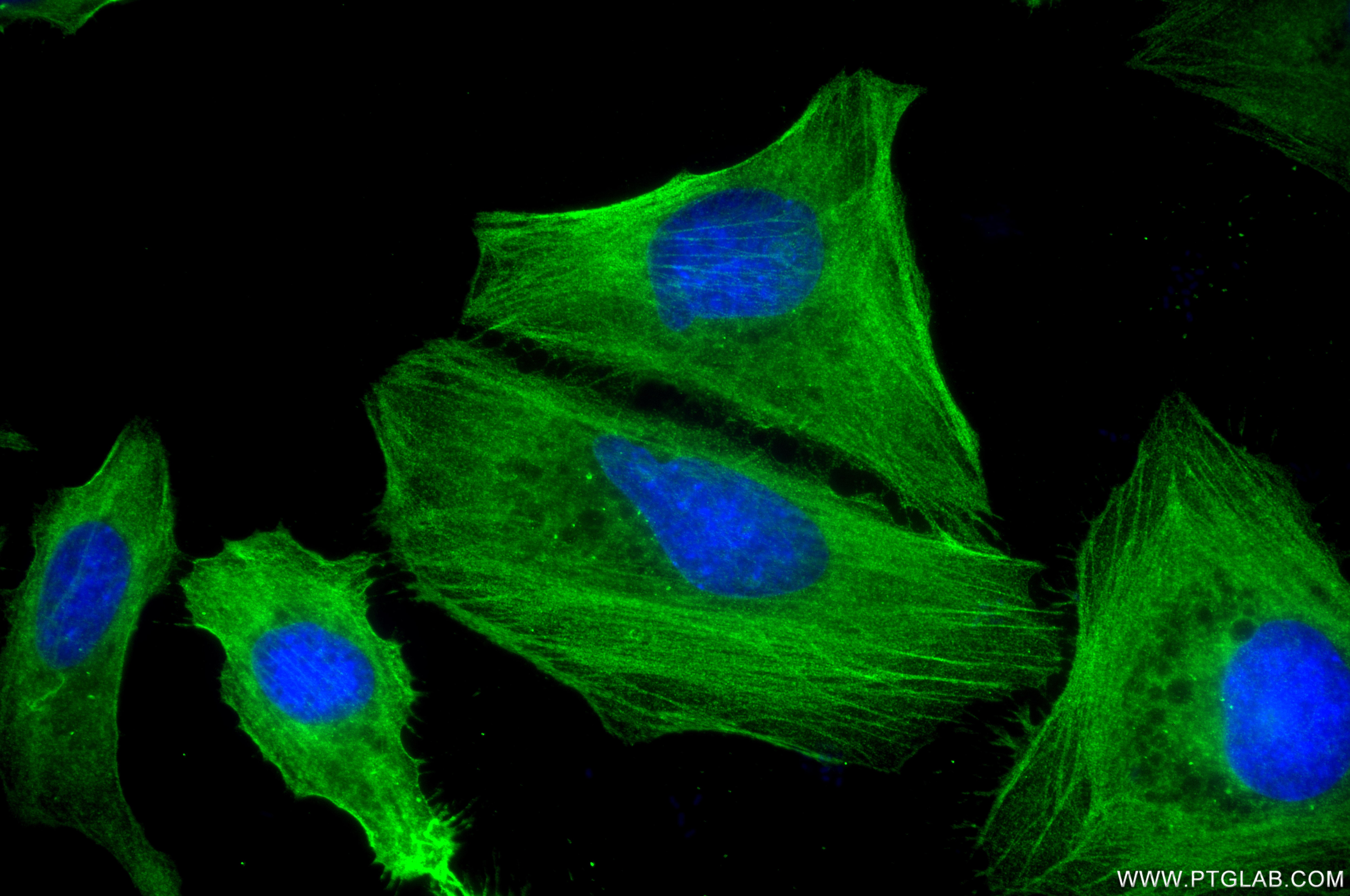 IF Staining of HeLa using 86959-3-RR (same clone as 86959-3-PBS) Immunofluorescence (IF) / fluorescent staining of HeLa cells using Filamin A Recombinant monoclonal antibody (86959-3-RR)
