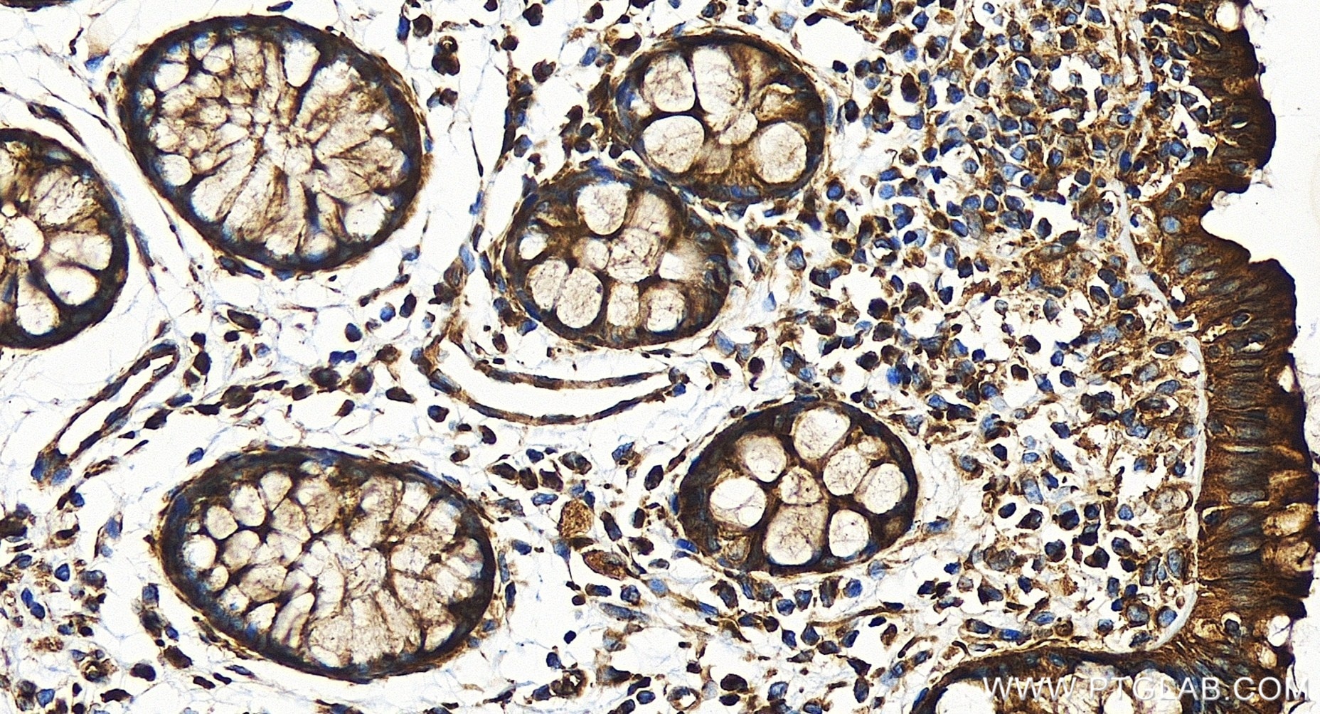 Immunohistochemistry (IHC) staining of human colon tissue using Filamin B Recombinant antibody (85202-1-RR)