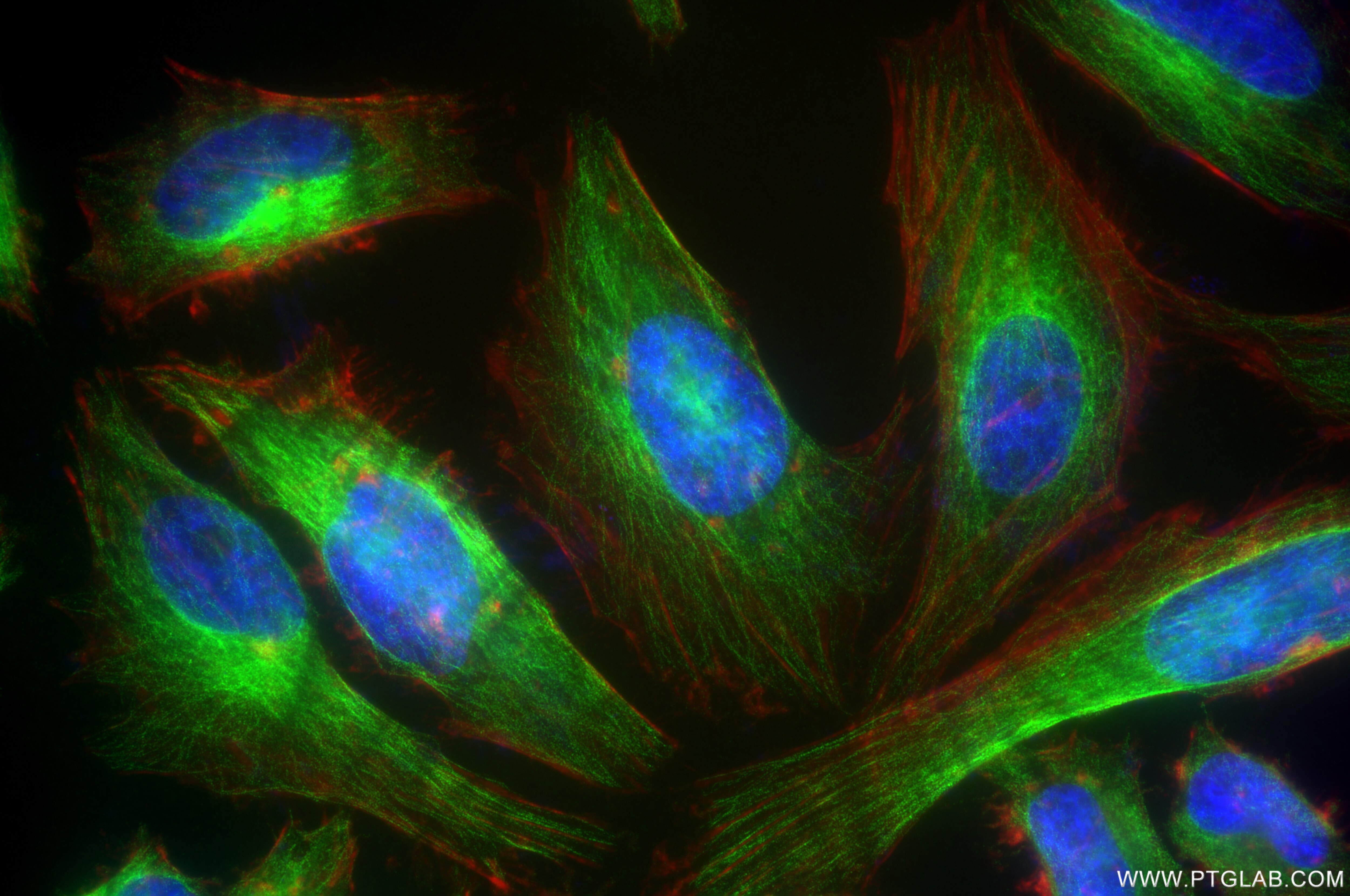 Immunofluorescence (IF) / fluorescent staining of HeLa cells using Filamin B Recombinant antibody (85202-1-RR)
