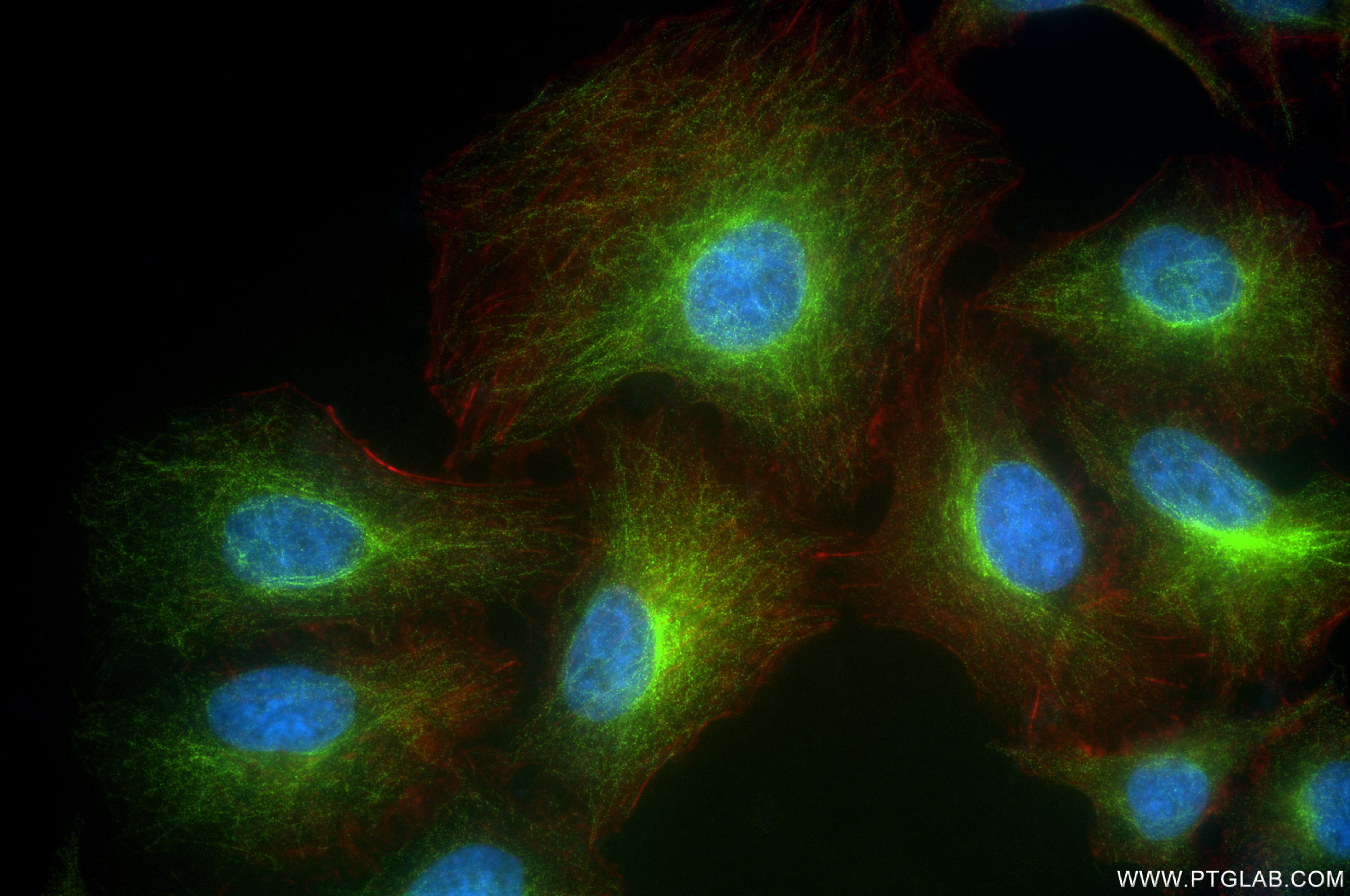 Immunofluorescence (IF) / fluorescent staining of A549 cells using Filamin B Recombinant antibody (85202-1-RR)