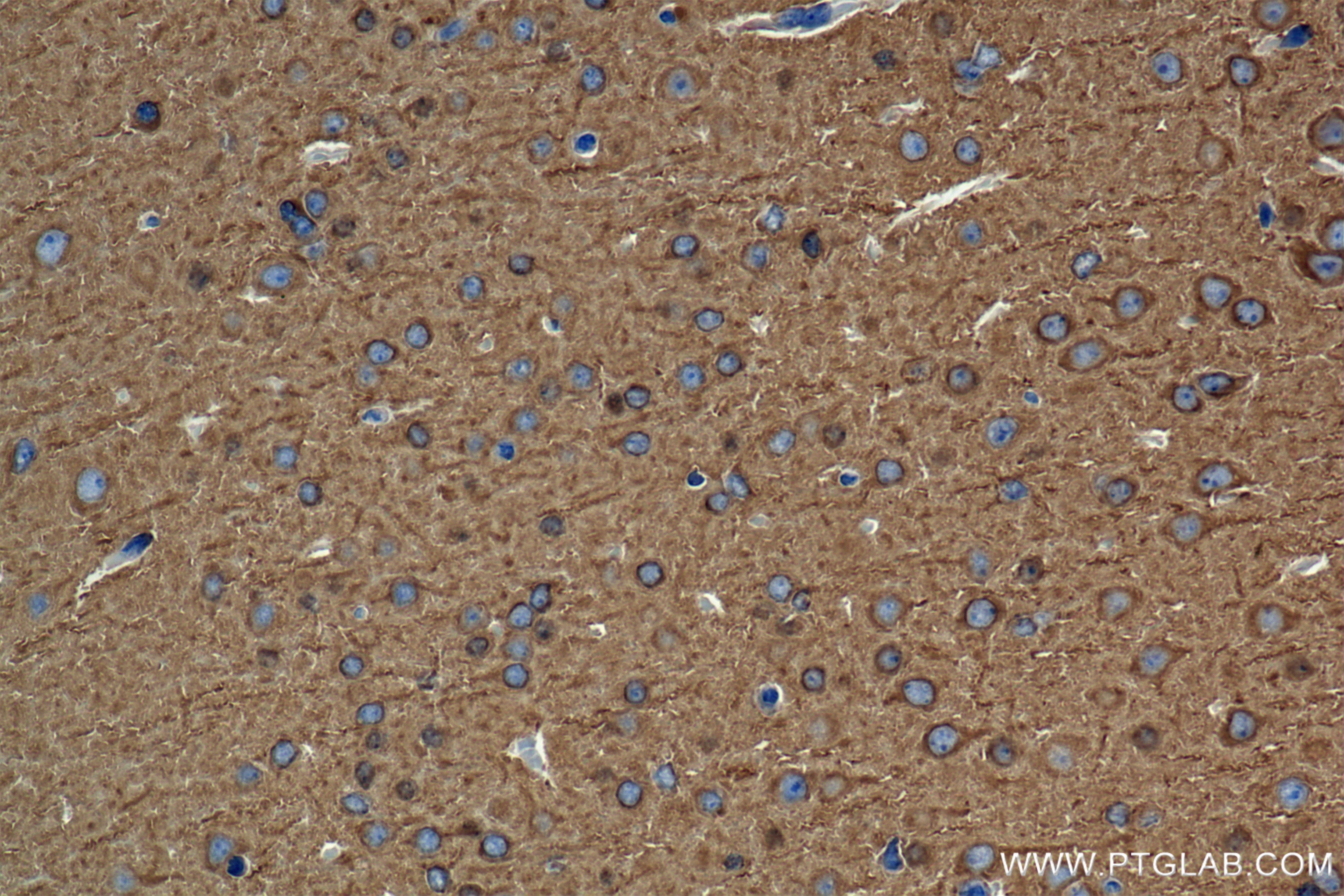 Immunohistochemistry (IHC) staining of mouse brain tissue using Filamin B Recombinant antibody (85202-1-RR)