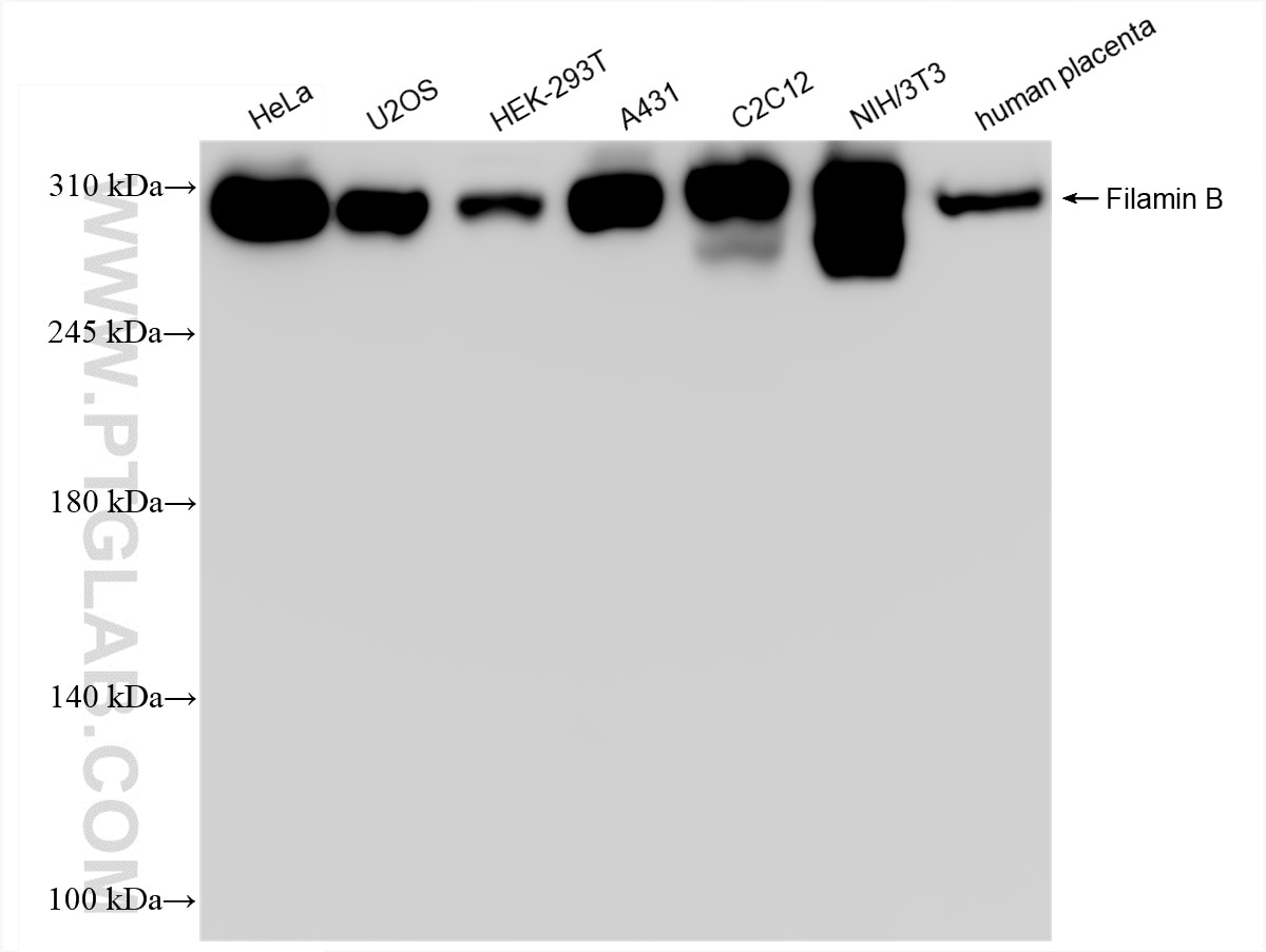 Western Blot (WB) analysis of various lysates using Filamin B Recombinant antibody (85202-3-RR)