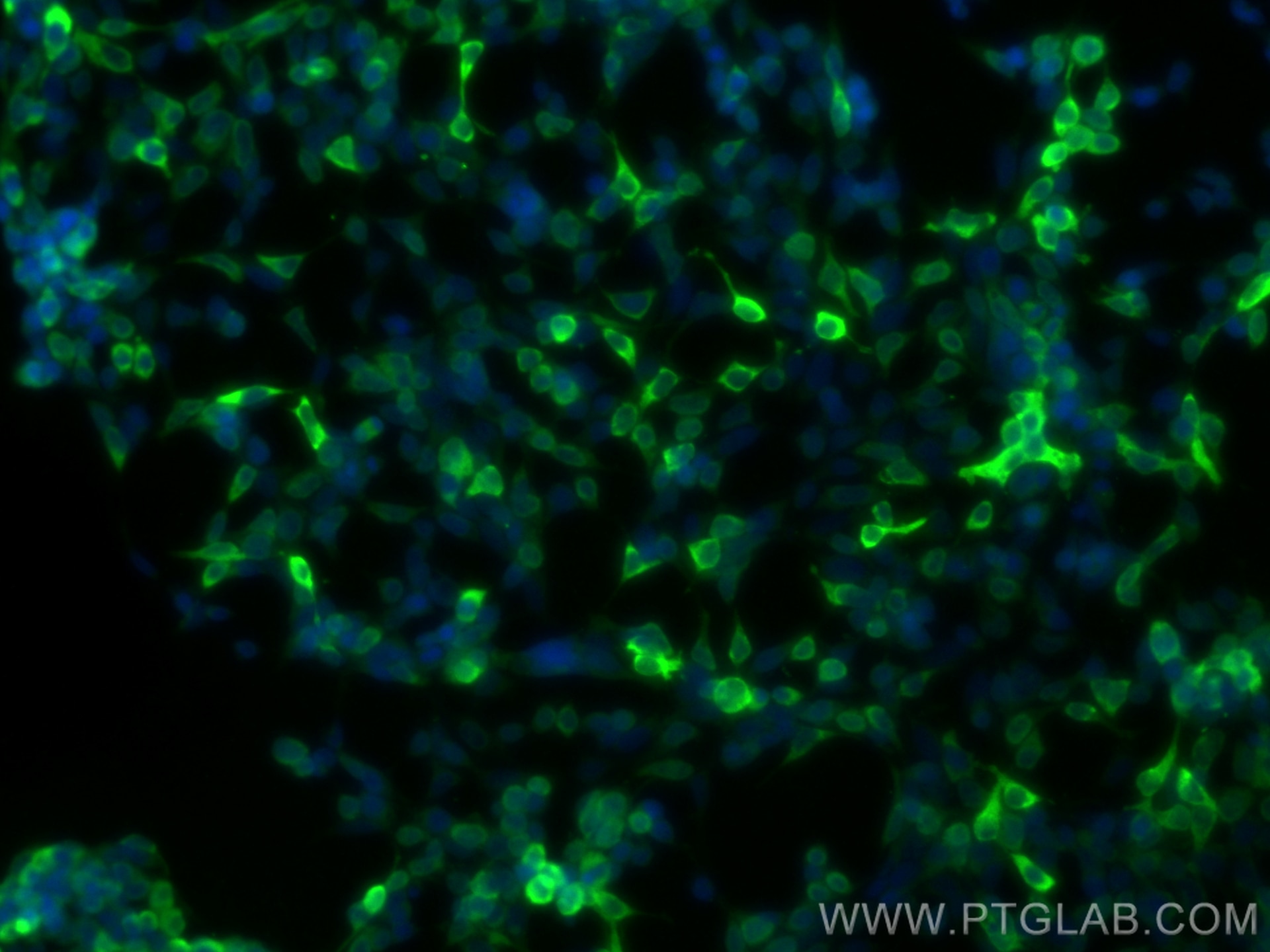 Immunofluorescence (IF) / fluorescent staining of Transfected HEK-293 cells using DYKDDDDK tag Polyclonal antibody (Binds to FLAG® t (20543-1-AP)