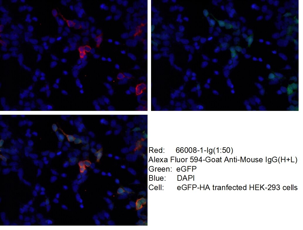 Immunofluorescence (IF) / fluorescent staining of Transfected HEK-293 cells using DDDDK tag Monoclonal antibody (Binds to FLAG® tag  (66008-1-Ig)