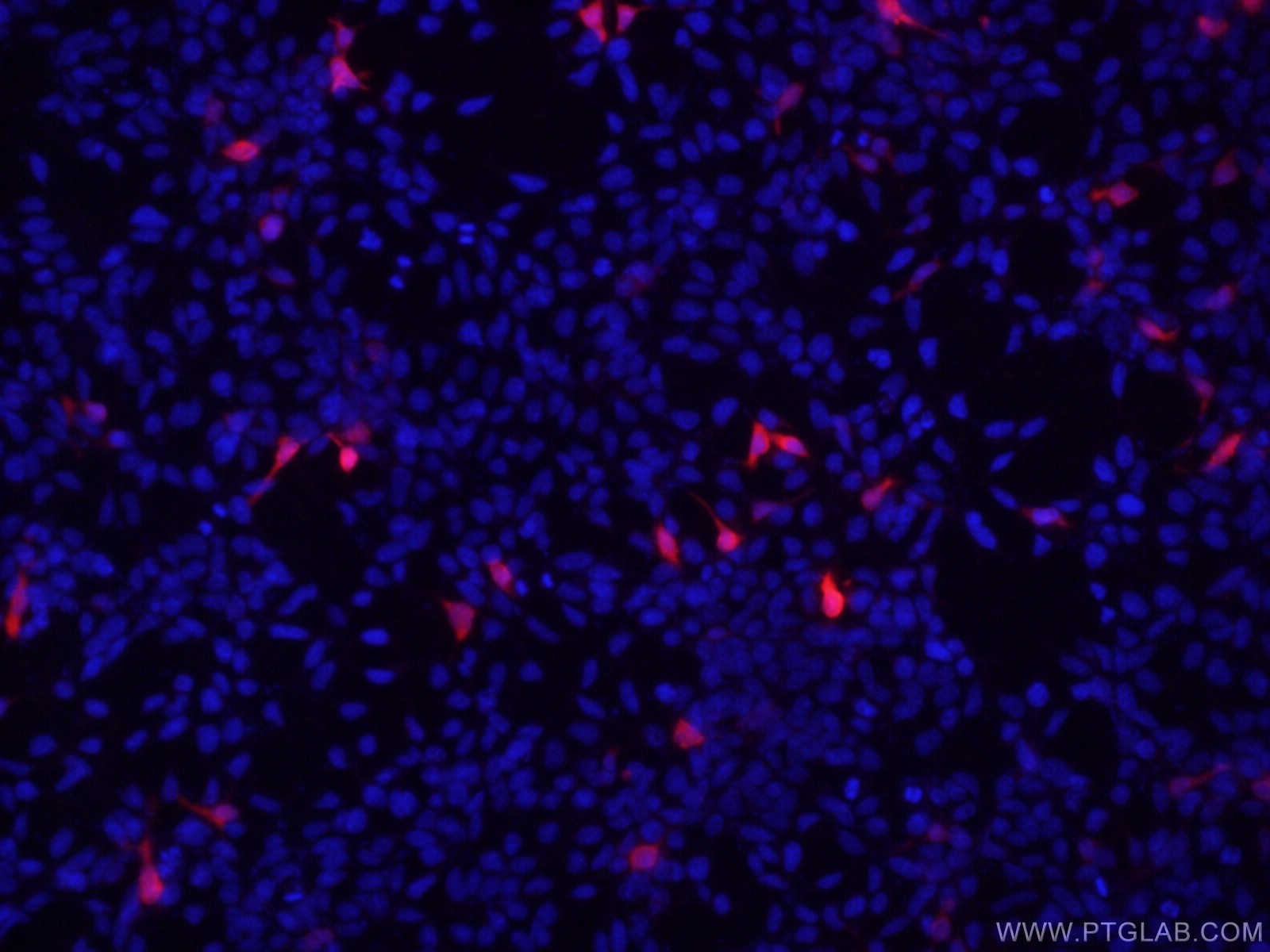 Immunofluorescence (IF) / fluorescent staining of Transfected HEK-293 cells using DYKDDDDK tag Monoclonal antibody (Binds to FLAG® t (66008-3-Ig)