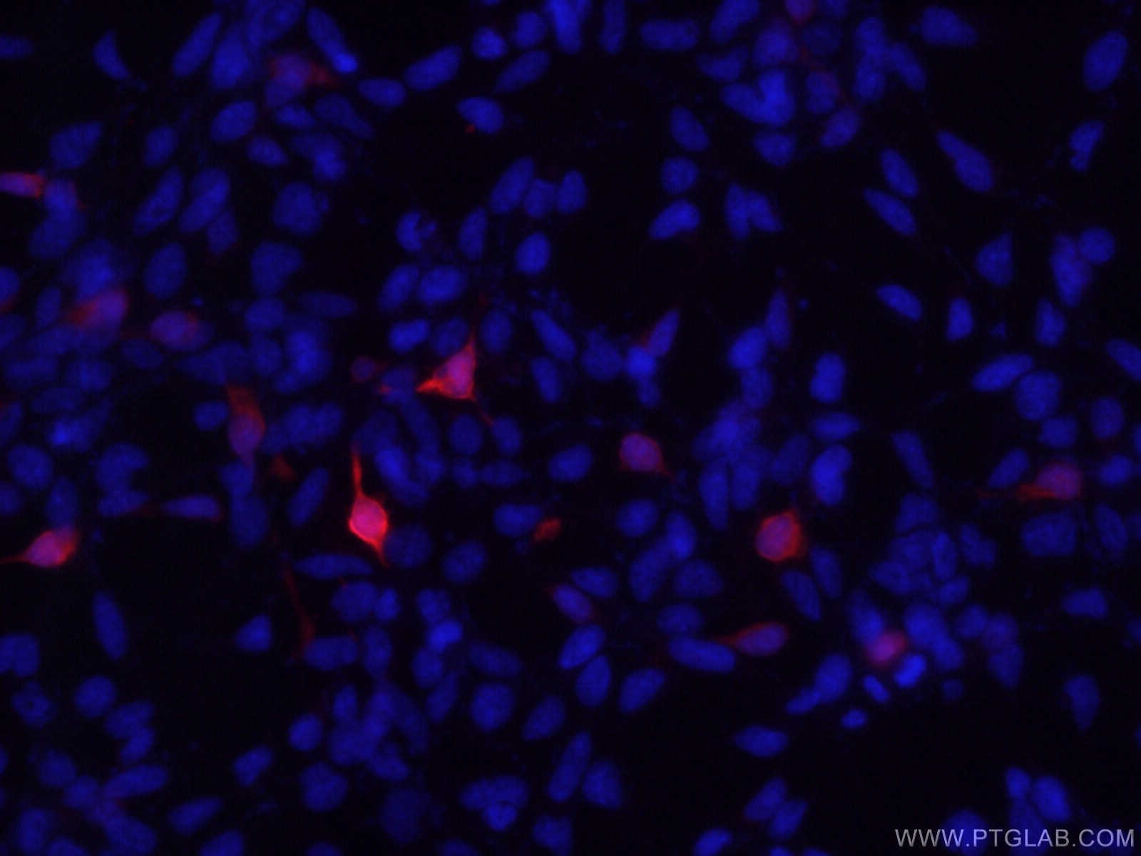 Immunofluorescence (IF) / fluorescent staining of Transfected HEK-293 cells using DYKDDDDK tag Monoclonal antibody (Binds to FLAG® t (66008-3-Ig)