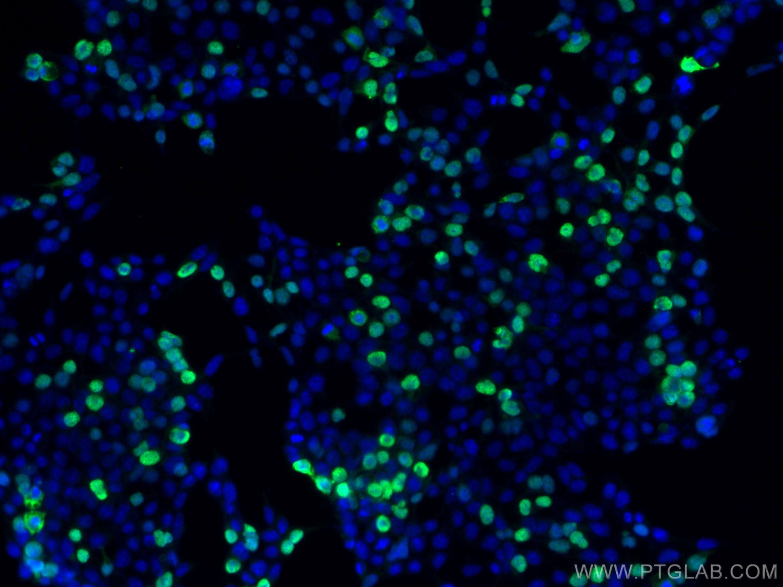 Immunofluorescence (IF) / fluorescent staining of Transfected HEK-293 cells using DYKDDDDK tag Monoclonal antibody (Binds to FLAG® t (66008-4-Ig)