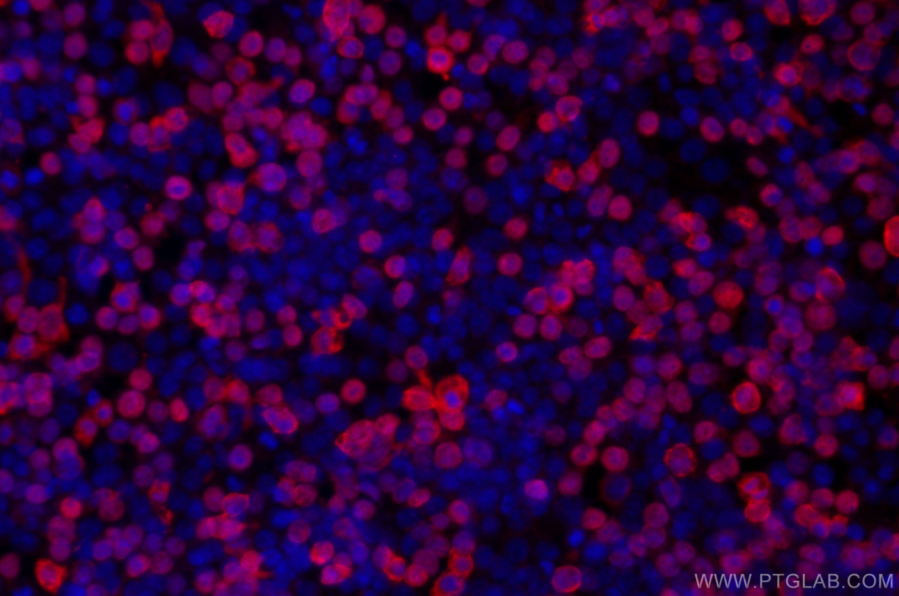 Immunofluorescence (IF) / fluorescent staining of Transfected HEK-293 cells using DYKDDDDK tag Monoclonal antibody (Binds to FLAG® t (66008-4-Ig)
